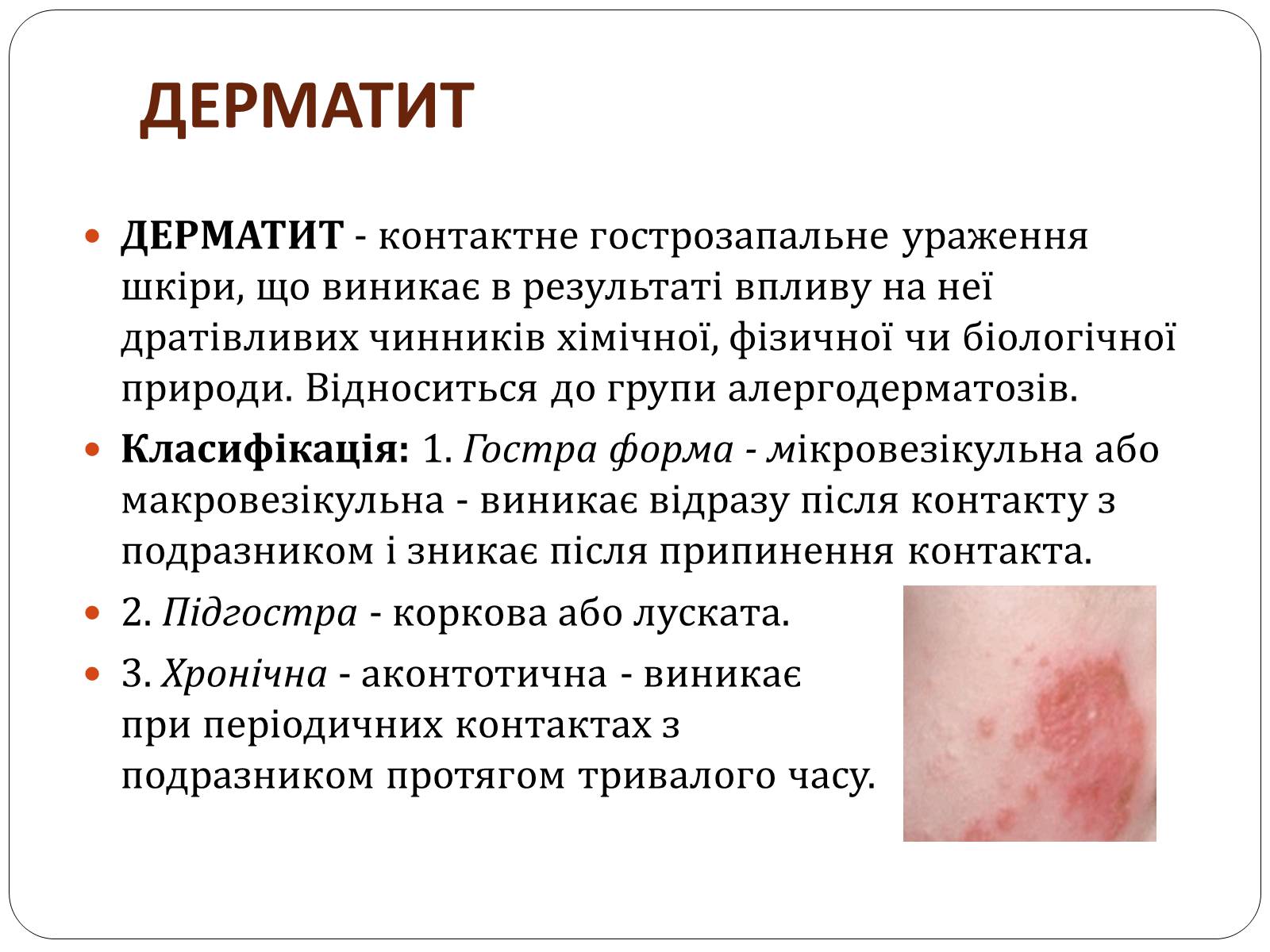 Презентація на тему «Захворювання шкіри» (варіант 3) - Слайд #2