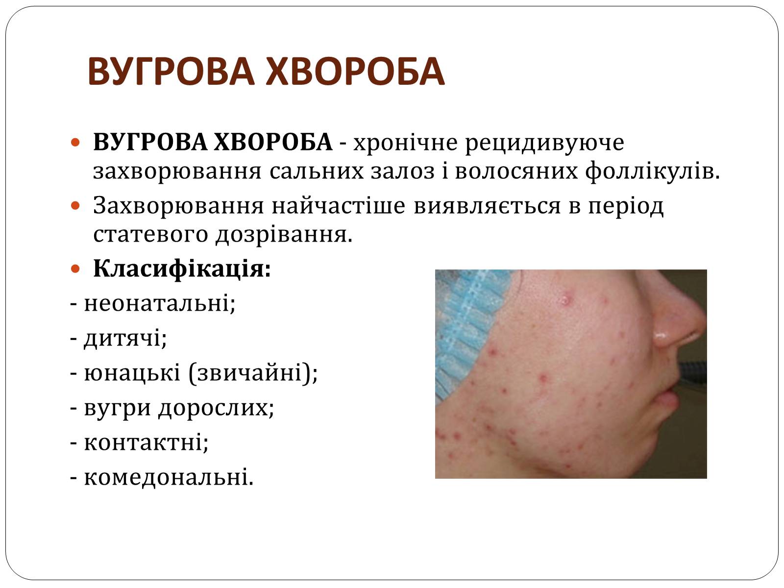 Презентація на тему «Захворювання шкіри» (варіант 3) - Слайд #10