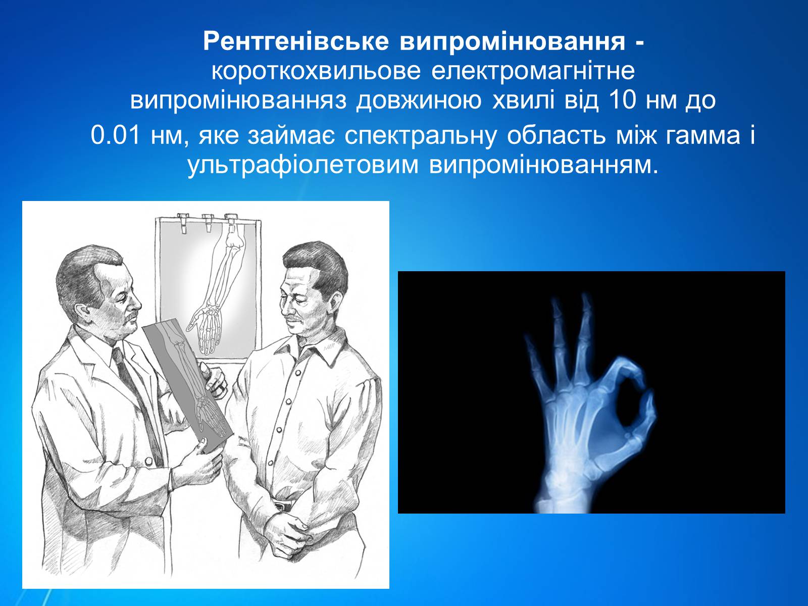 Презентація на тему «Рентгенівське випромінювання» (варіант 7) - Слайд #2