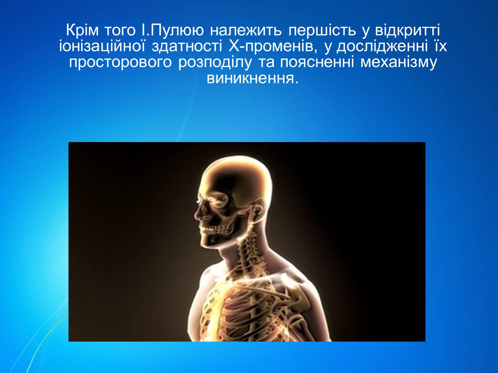 Презентація на тему «Рентгенівське випромінювання» (варіант 7) - Слайд #6