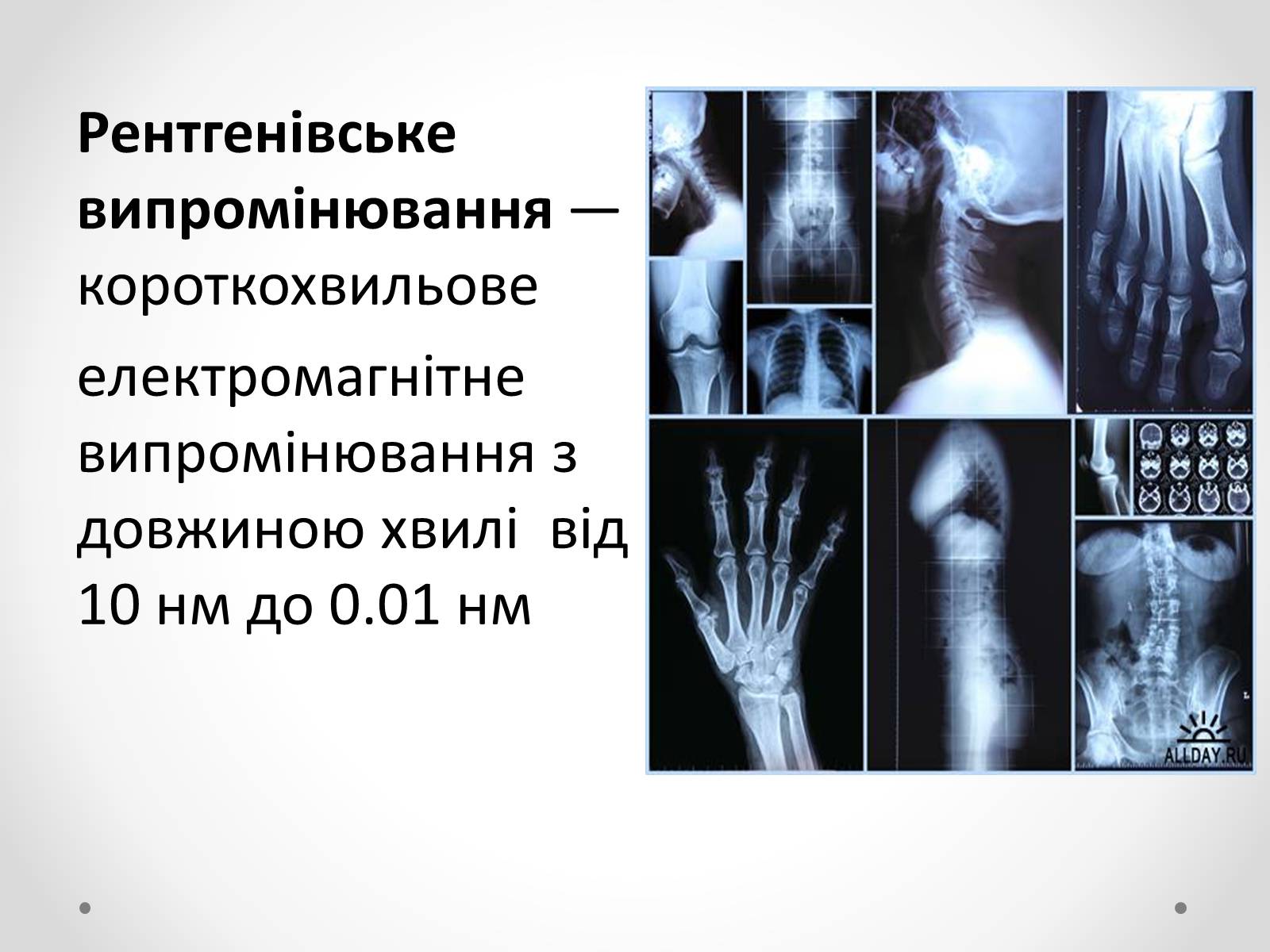 Презентація на тему «Рентгенівське випромінювання» (варіант 8) - Слайд #2
