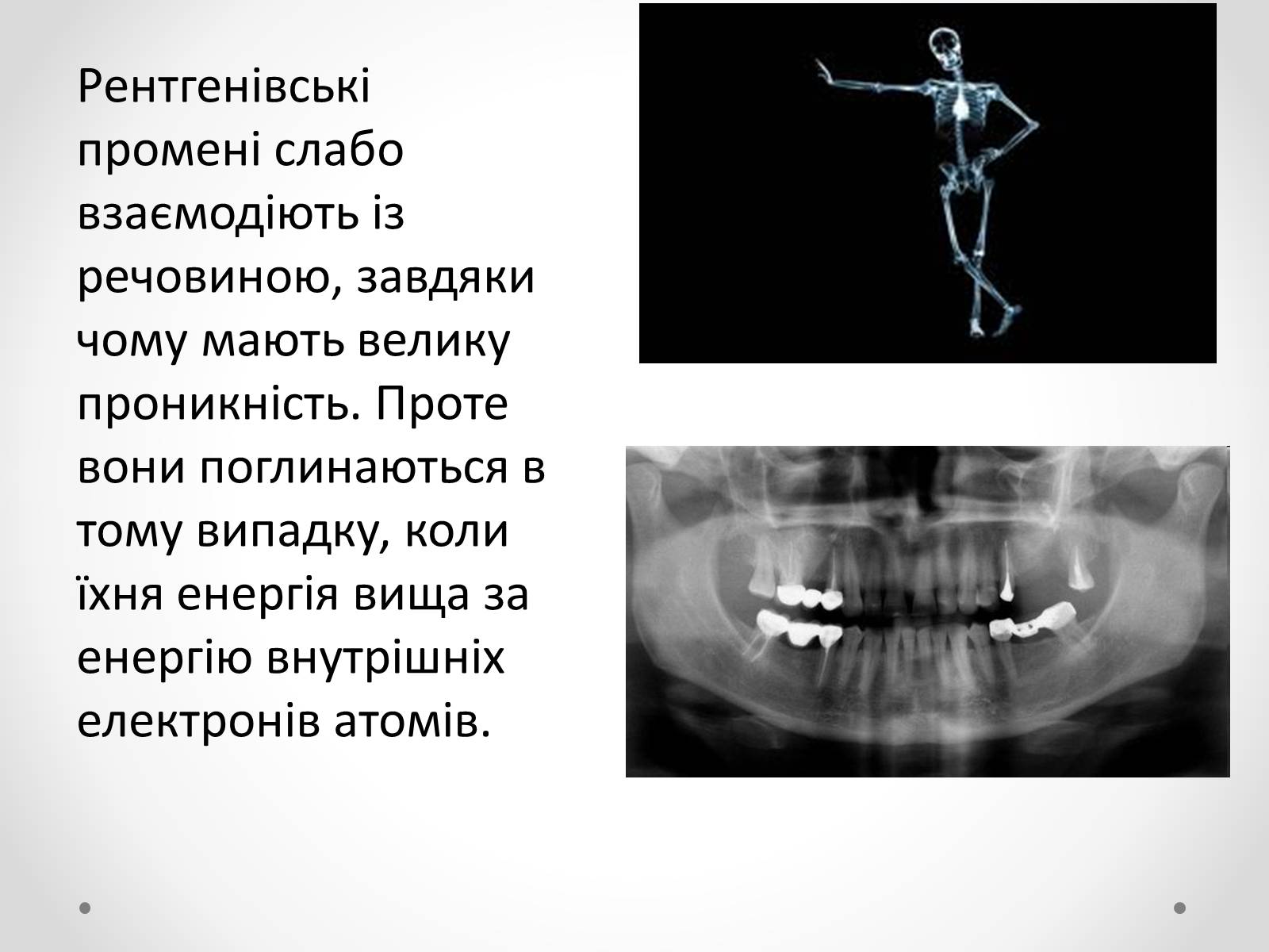 Презентація на тему «Рентгенівське випромінювання» (варіант 8) - Слайд #10