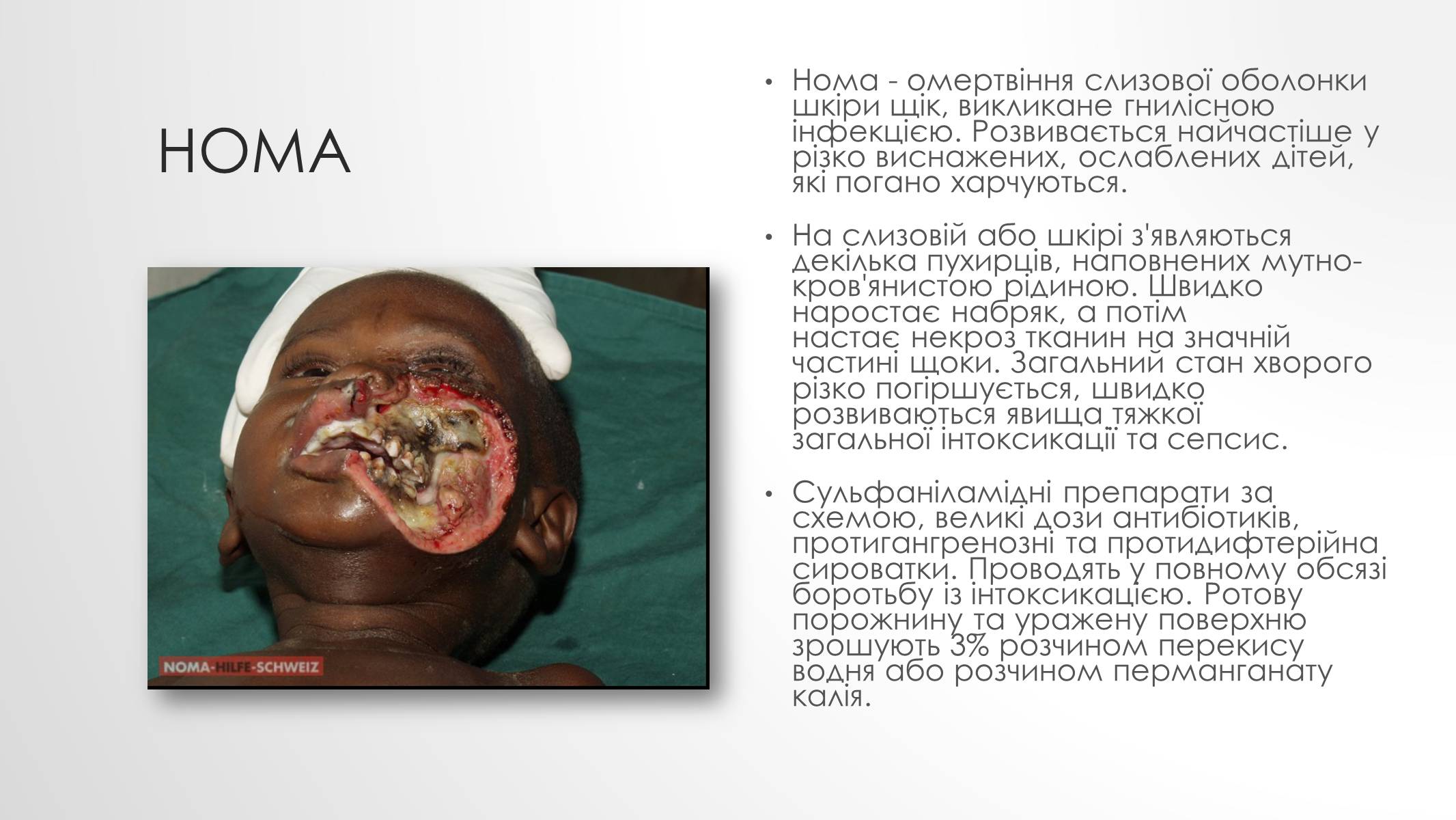 Презентація на тему «Шкірні захворювання» - Слайд #10