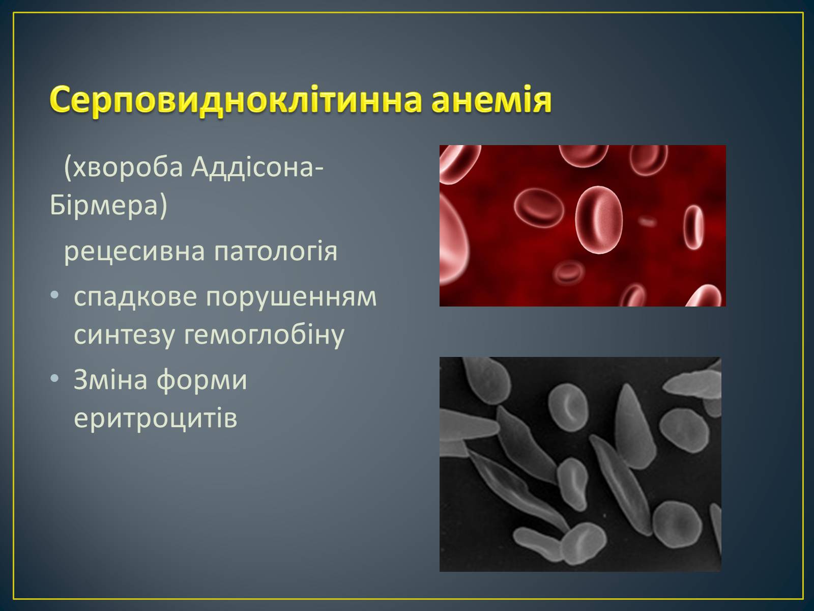 Презентація на тему «Типи генетичних хвороб людини» (варіант 1) - Слайд #4