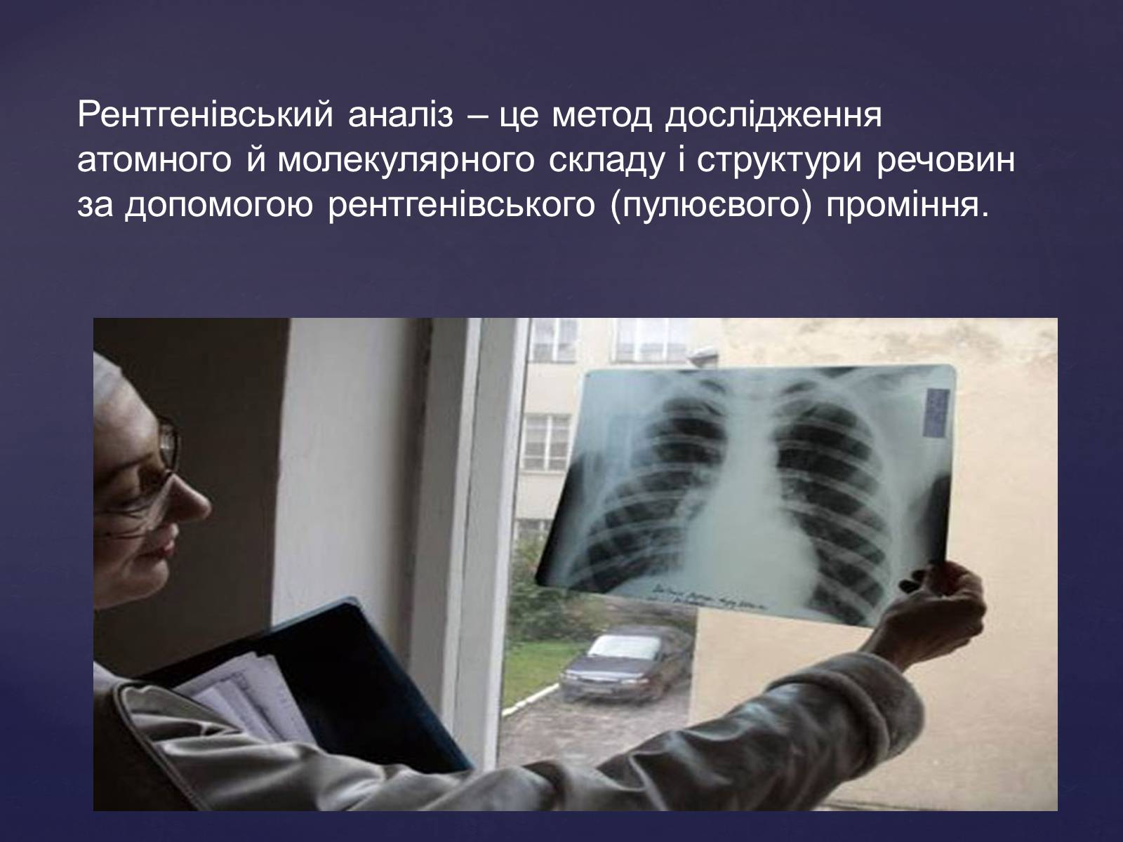 Презентація на тему «Рентгенівське випромінювання» (варіант 2) - Слайд #16