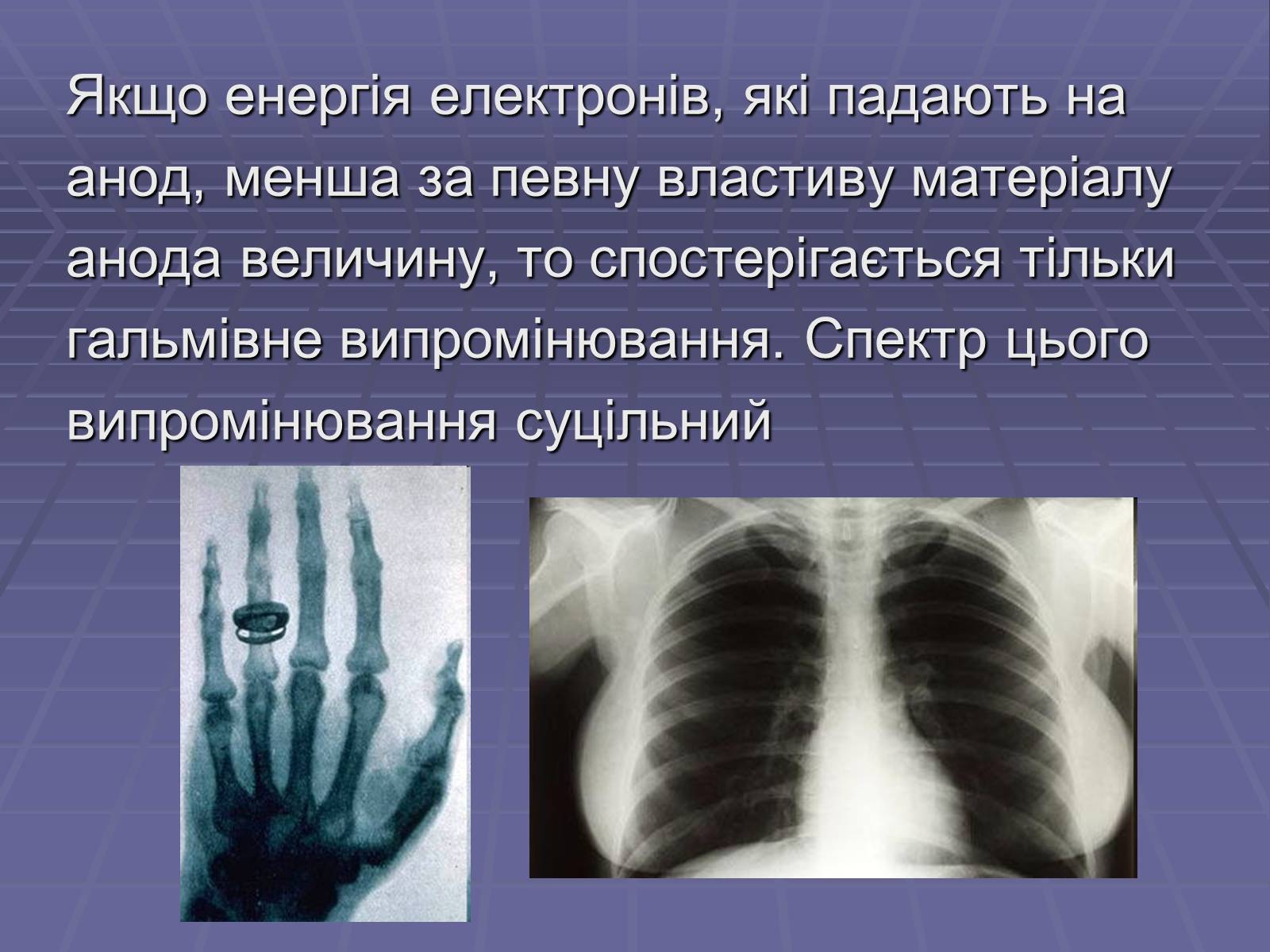 Презентація на тему «Рентгенівське випромінювання» (варіант 3) - Слайд #9