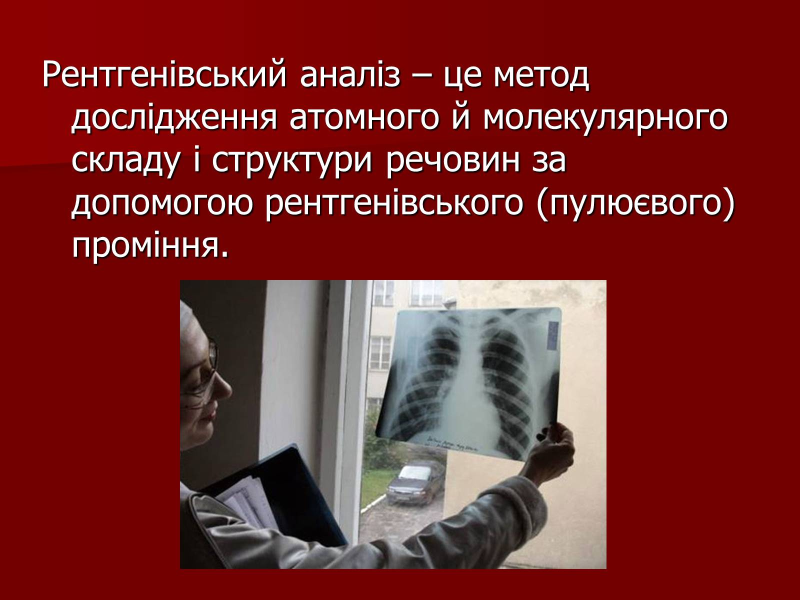 Презентація на тему «Рентгенівське випромінювання» (варіант 3) - Слайд #16