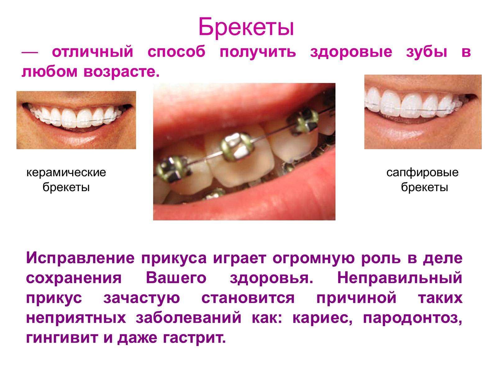 Презентація на тему «Зуби» (варіант 4) - Слайд #15