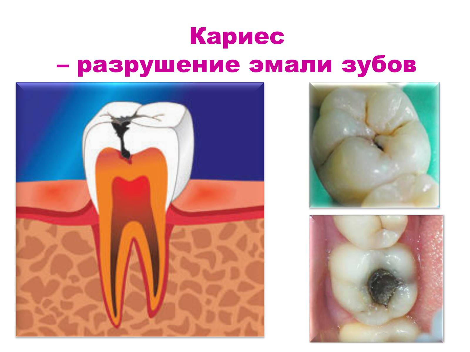 Презентація на тему «Зуби» (варіант 4) - Слайд #16