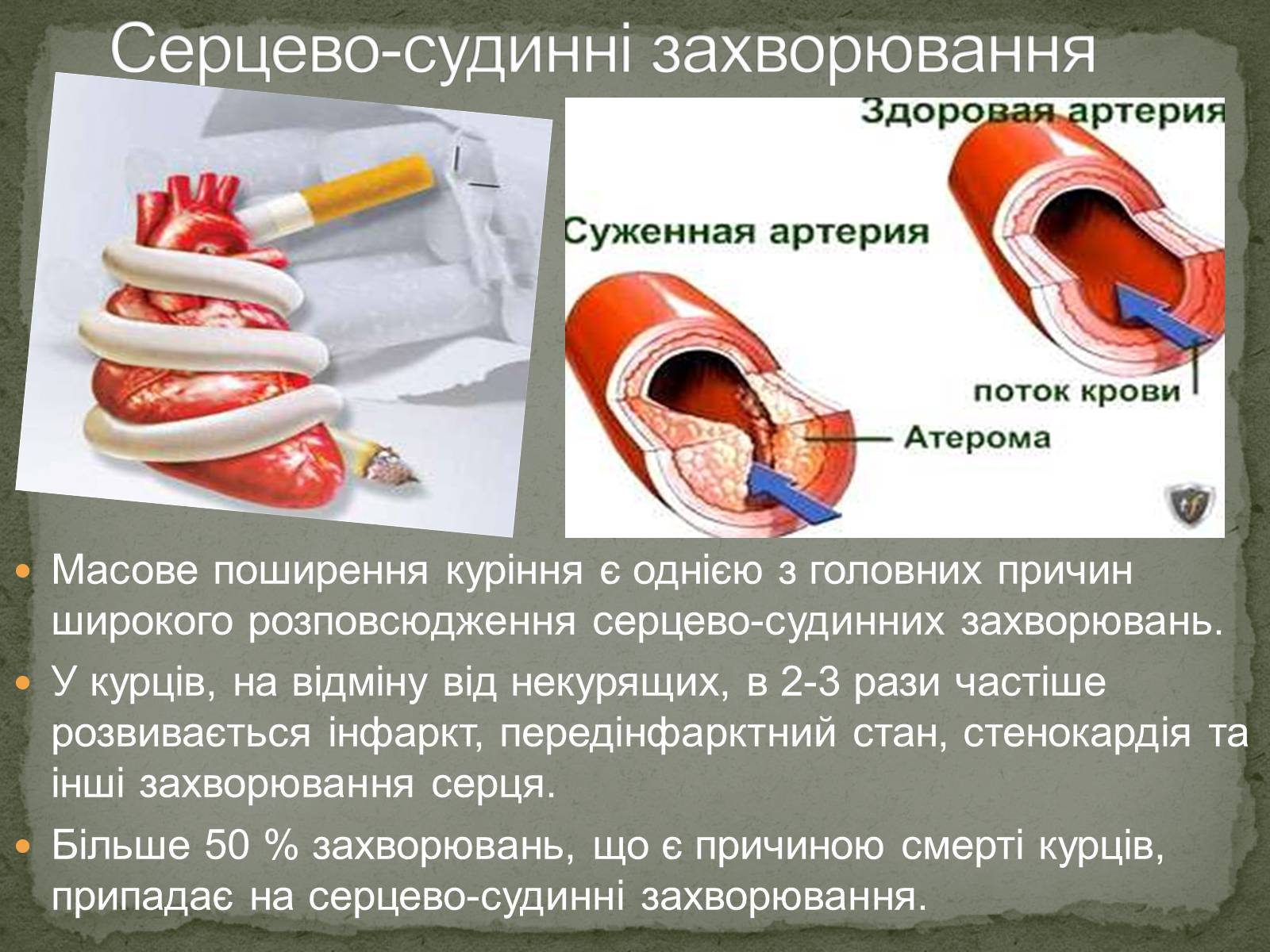 Презентація на тему «Тютюнопаління» (варіант 5) - Слайд #21