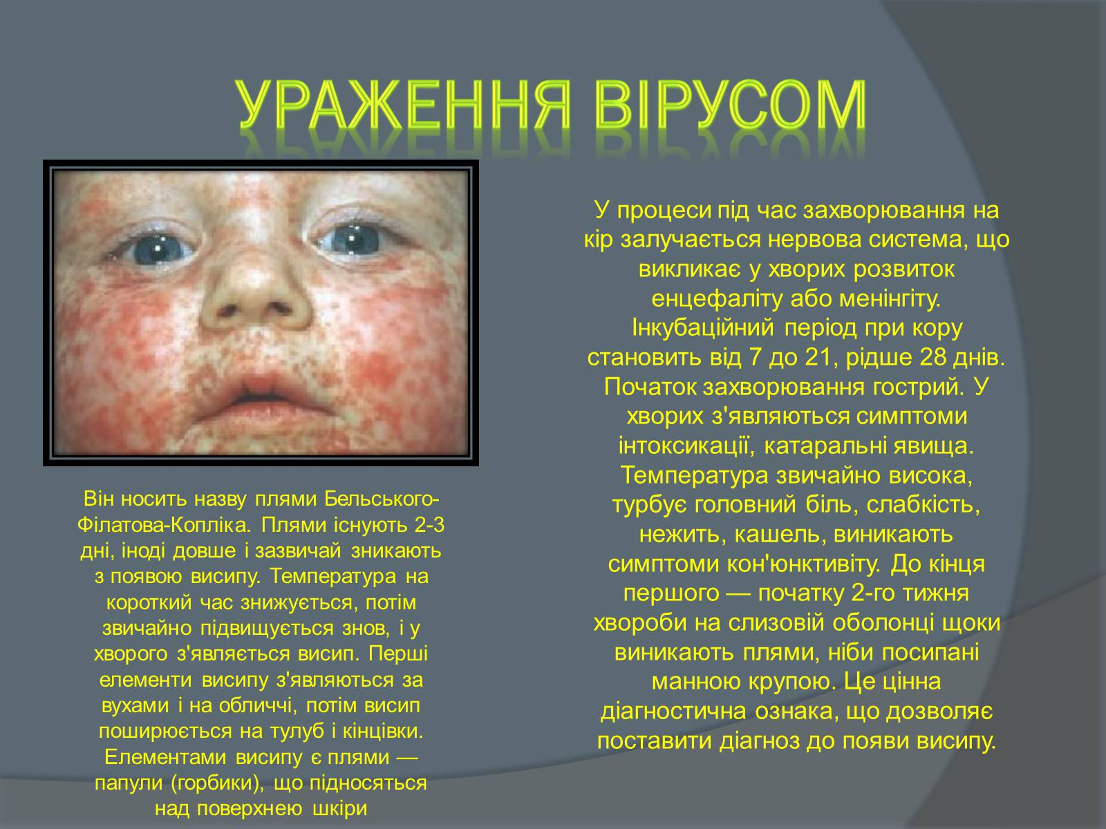 Презентація на тему «Вірусні захворювання» (варіант 2) - Слайд #8