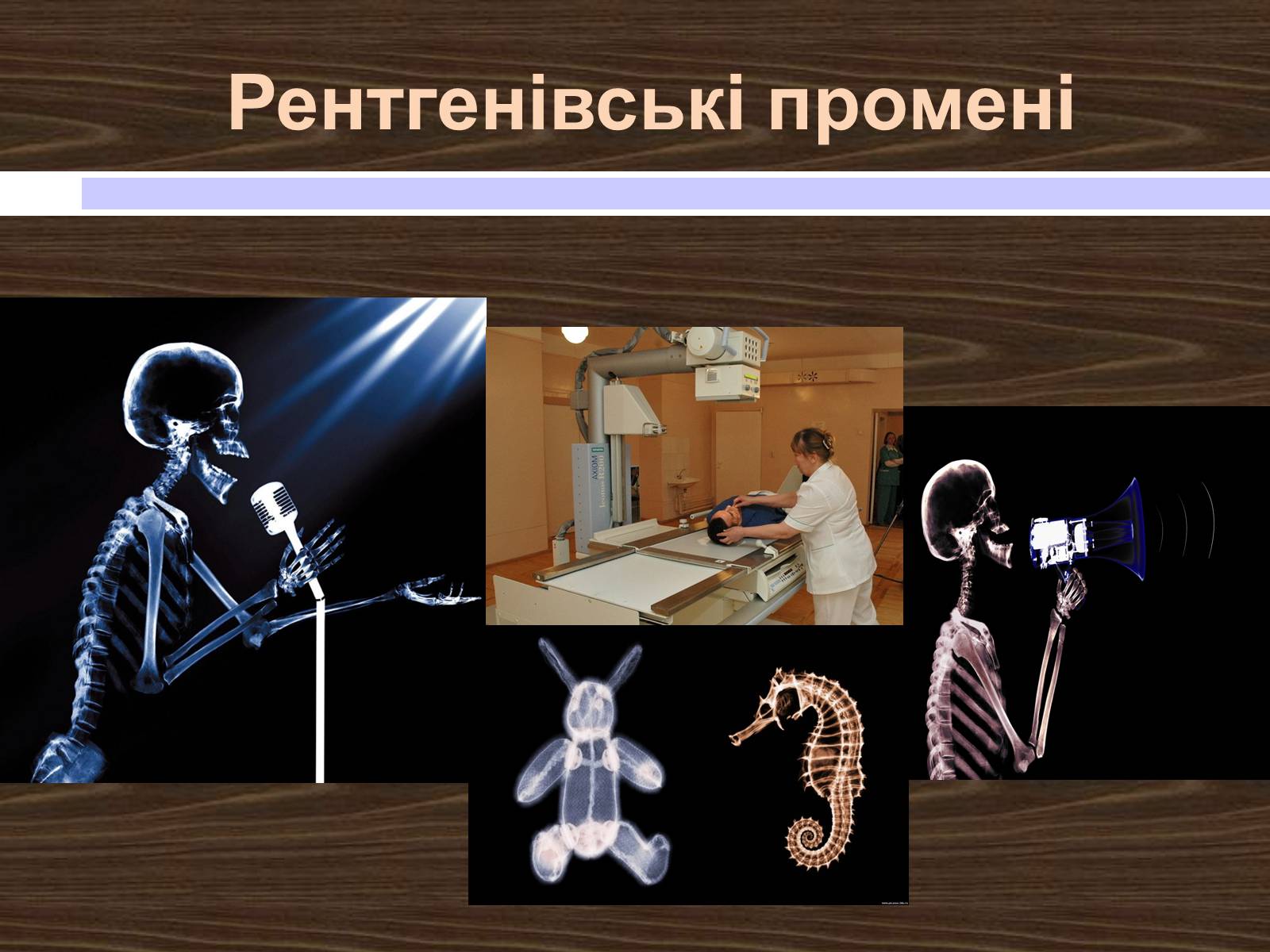 Презентація на тему «Рентгенівські промені» - Слайд #11