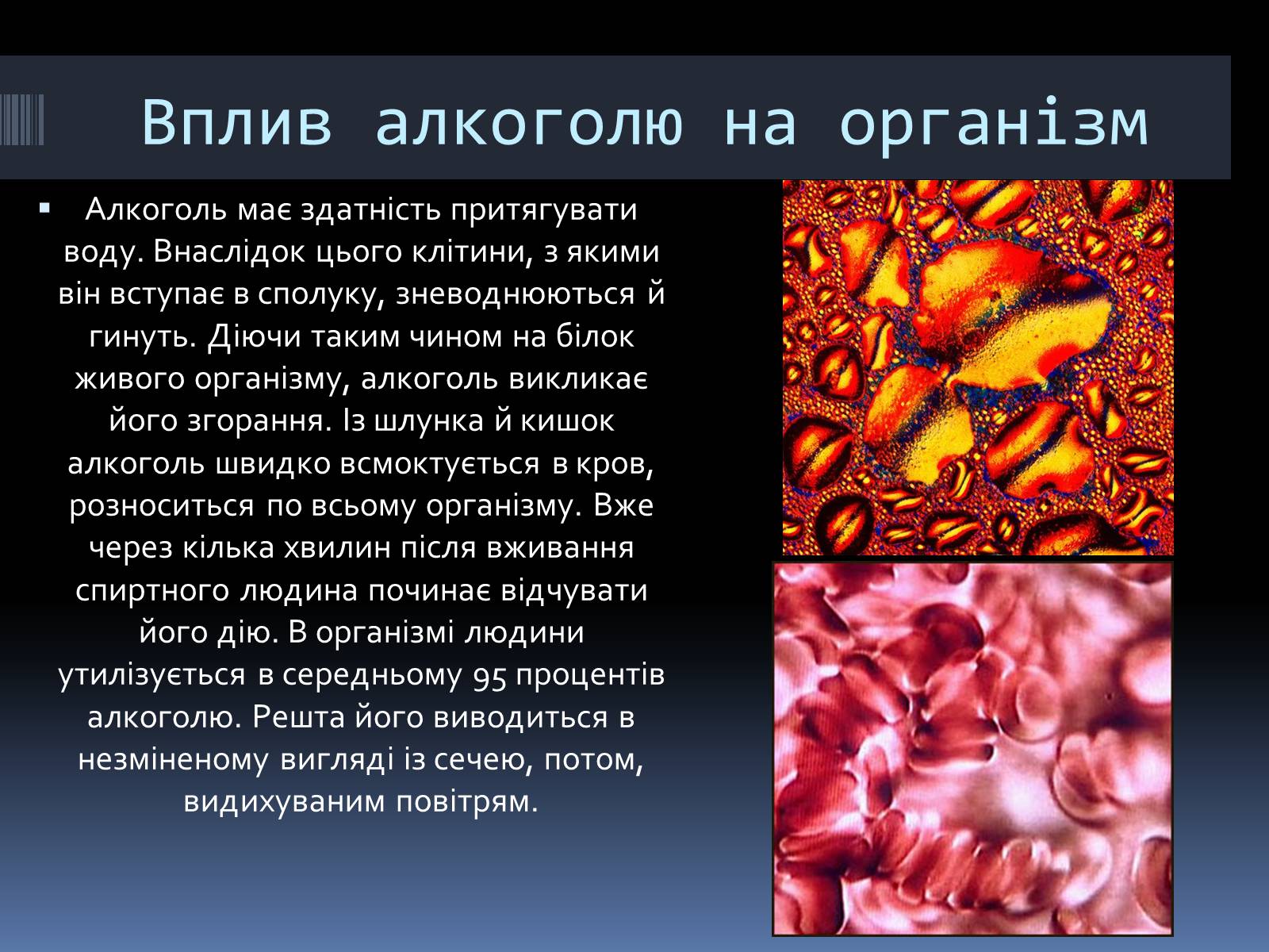 Презентація на тему «Вплив алкоголю на організм людини» (варіант 4) - Слайд #8