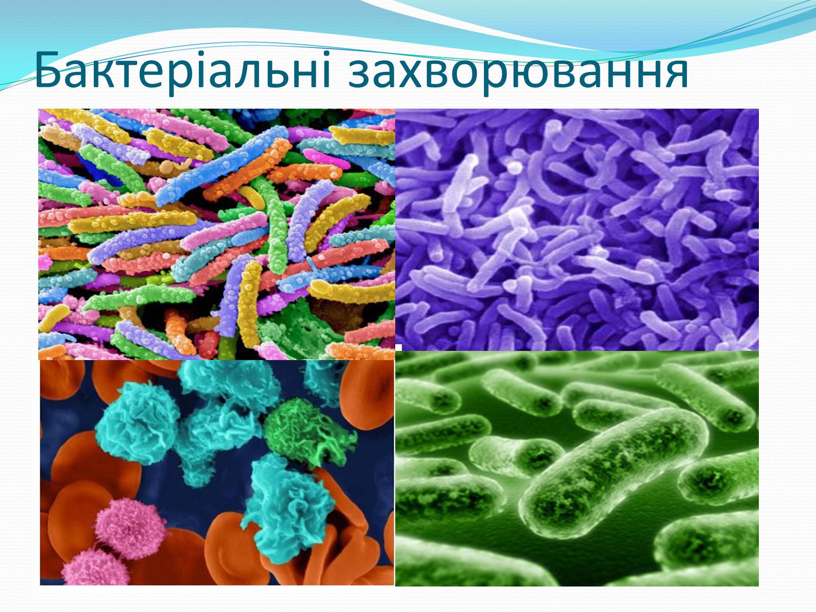 Презентація на тему «Профілактика бактеріальних захворювань людини» - Слайд #4