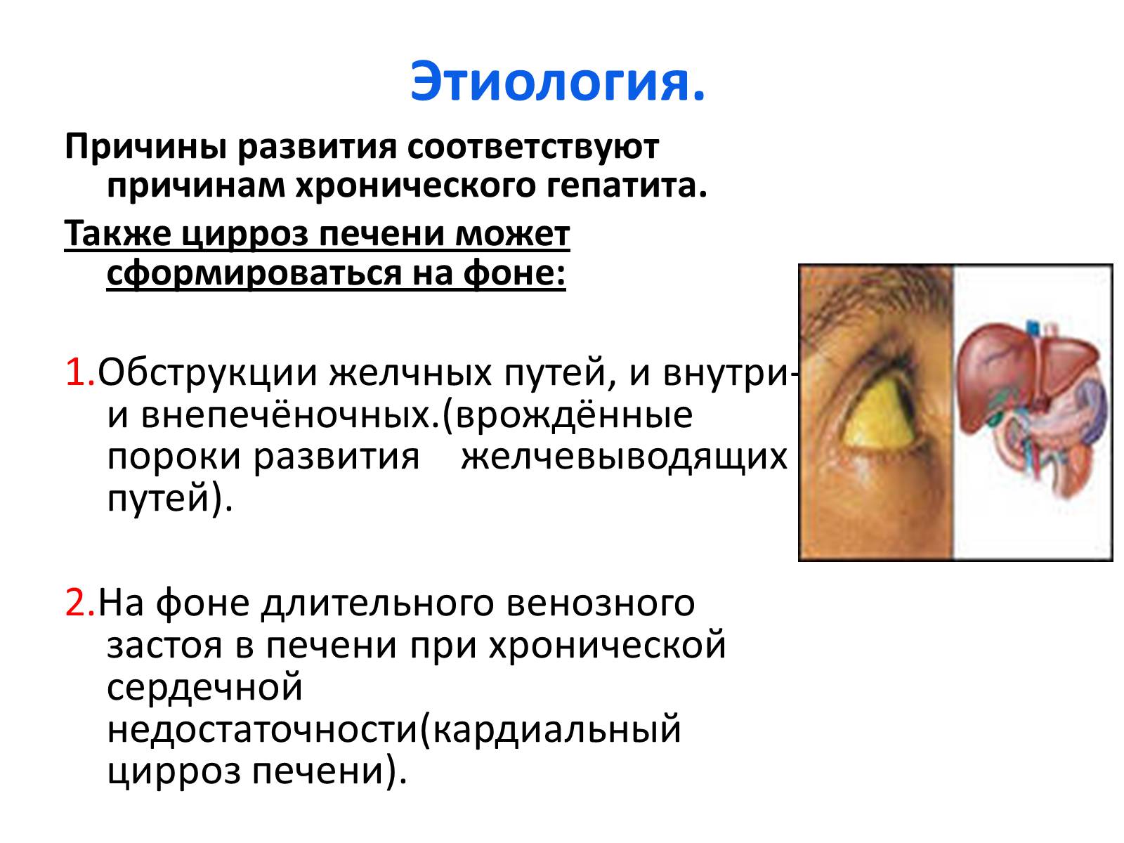 Презентація на тему «Цирроз печени» - Слайд #4