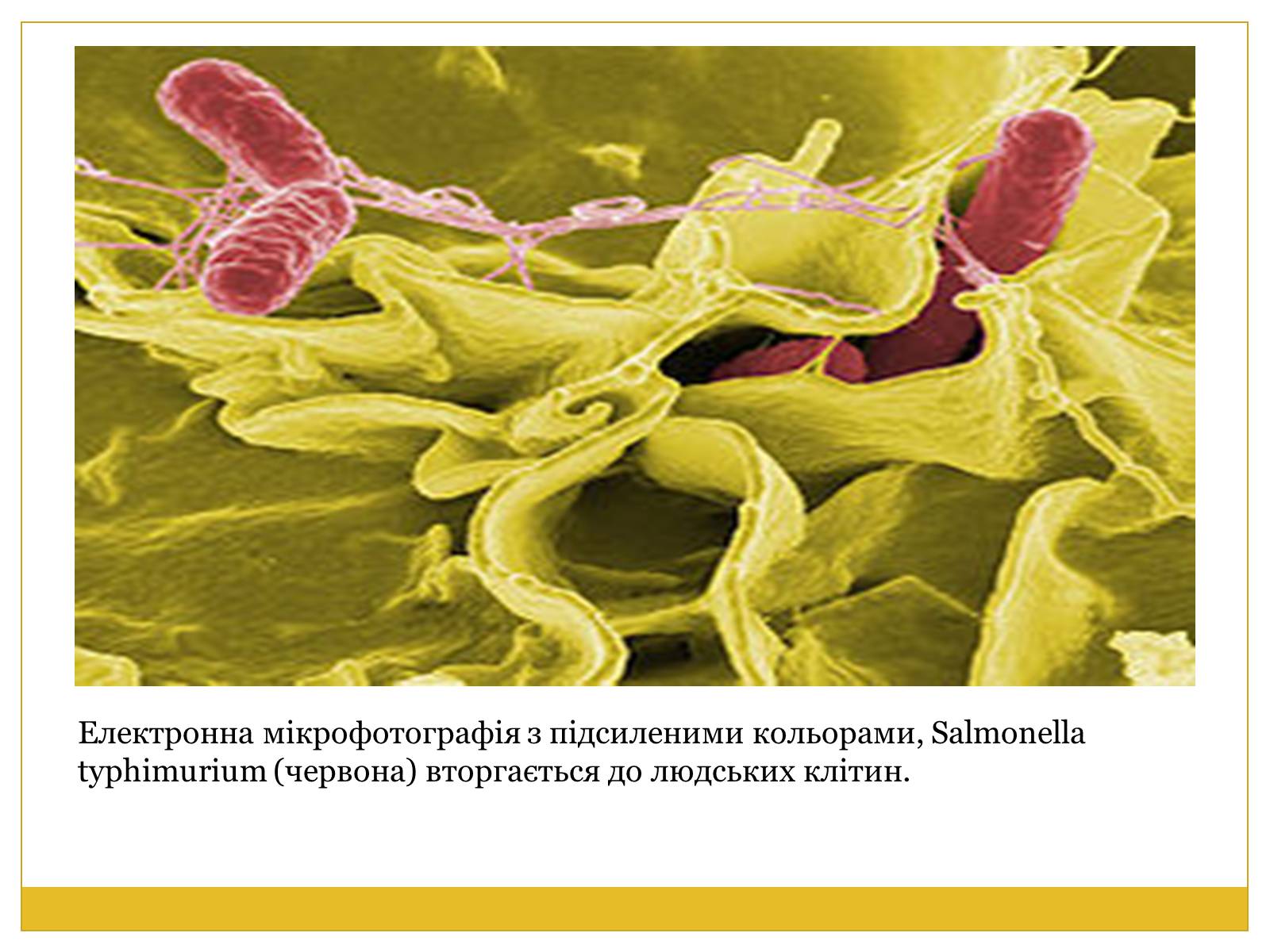 Презентація на тему «Бактерії та здоров’я людини» - Слайд #19