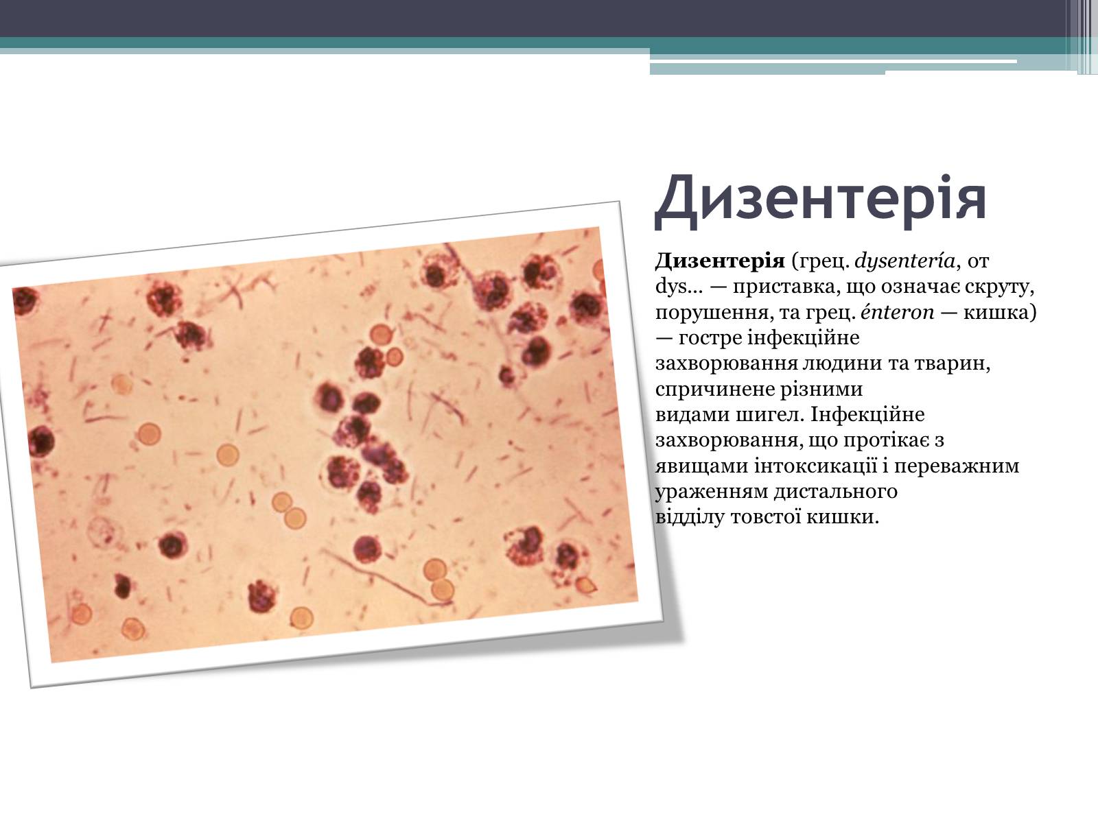 Презентація на тему «Дитячі інфекційні захворювання» - Слайд #8