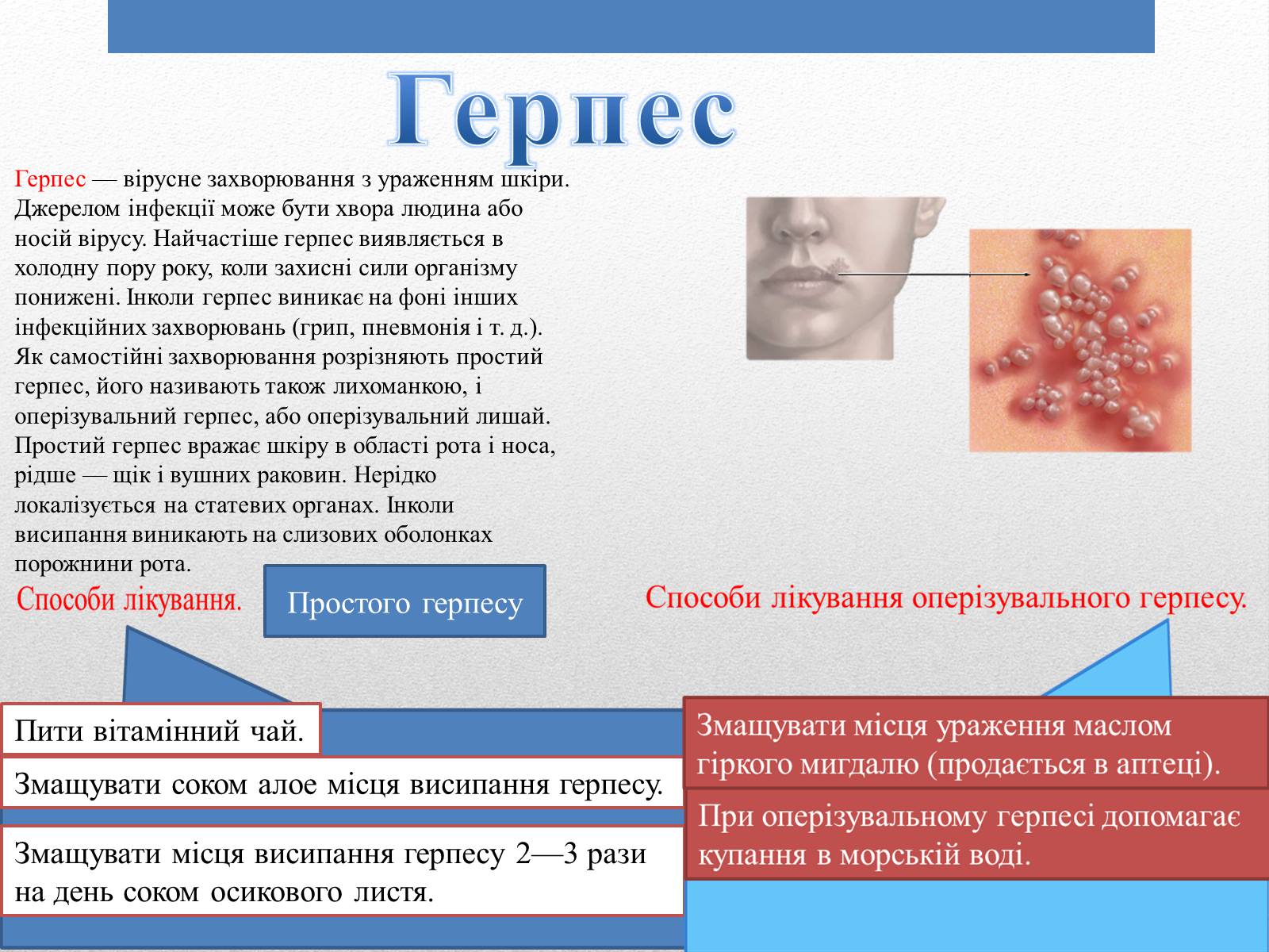 Презентація на тему «Захворювання Шкіри» (варіант 1) - Слайд #8