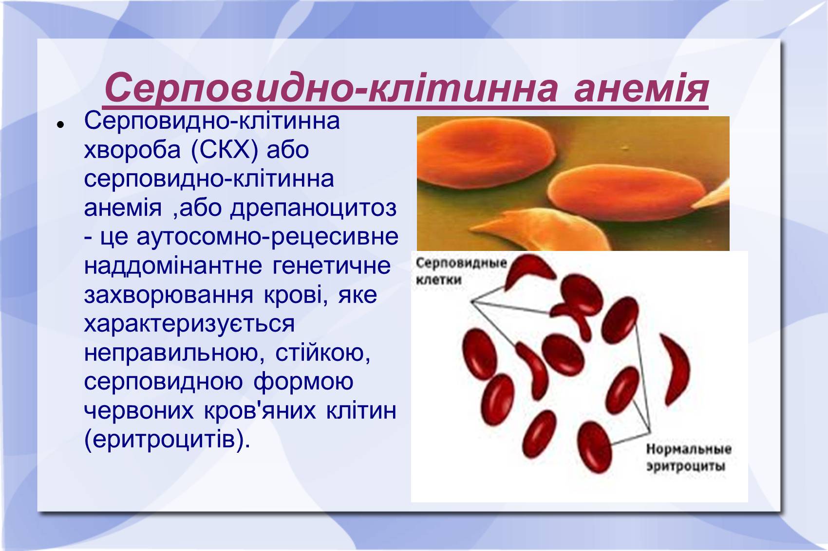 Презентація на тему «Серповидно-клітинна анемія» - Слайд #7