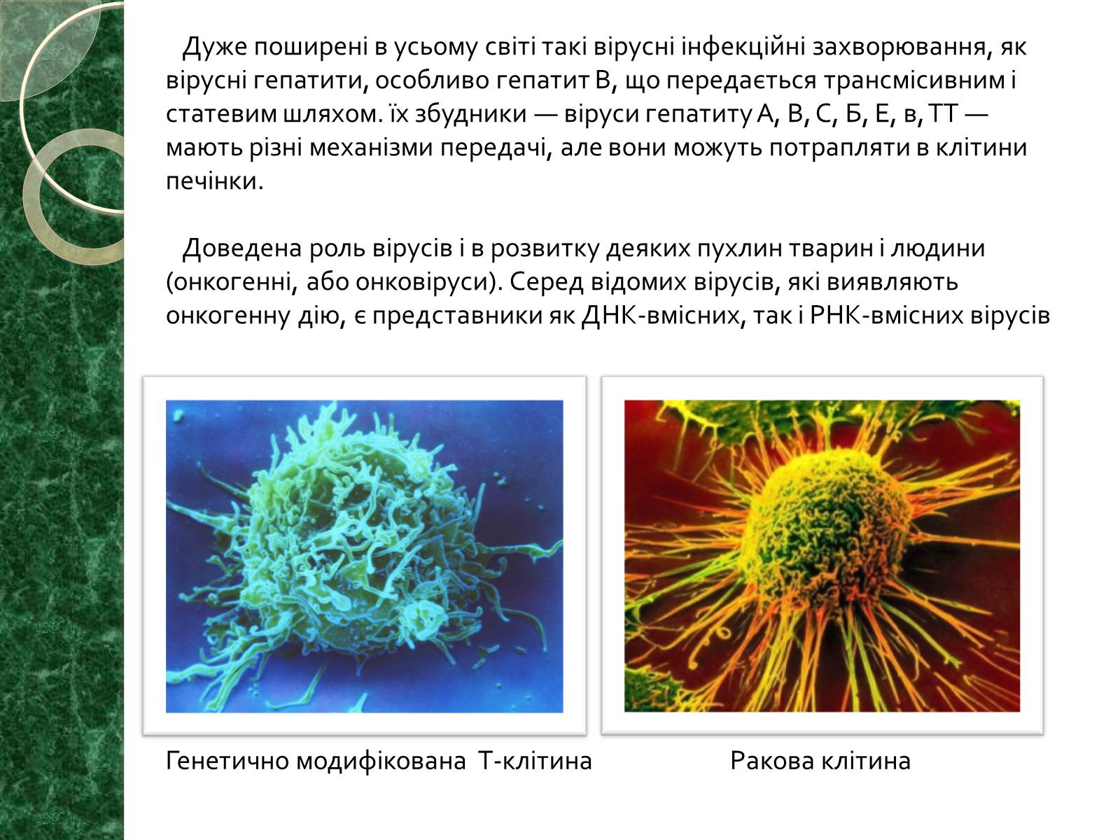 Презентація на тему «Віруси» (варіант 15) - Слайд #17