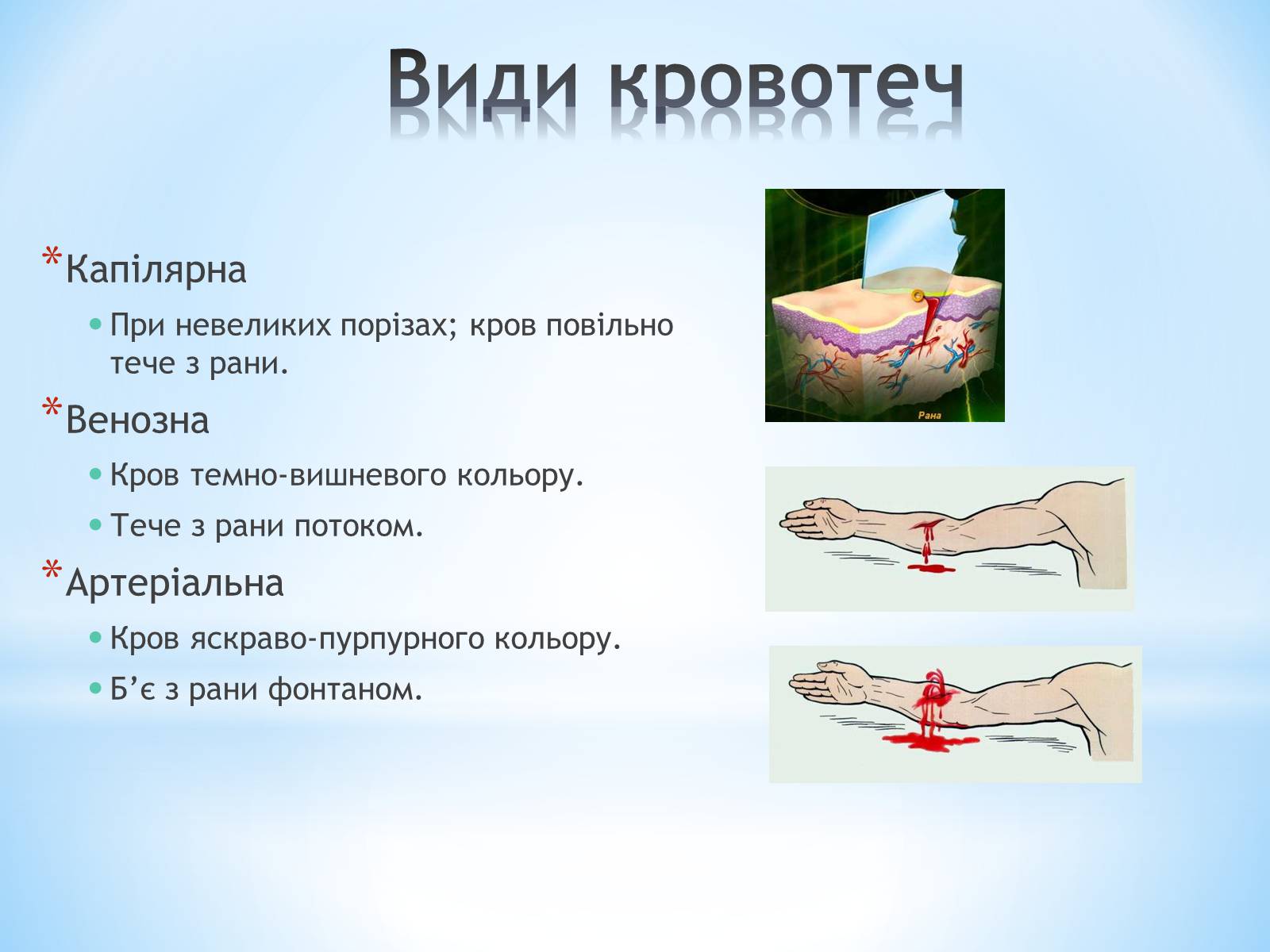 Презентація на тему «Види кровотеч» (варіант 2) - Слайд #2