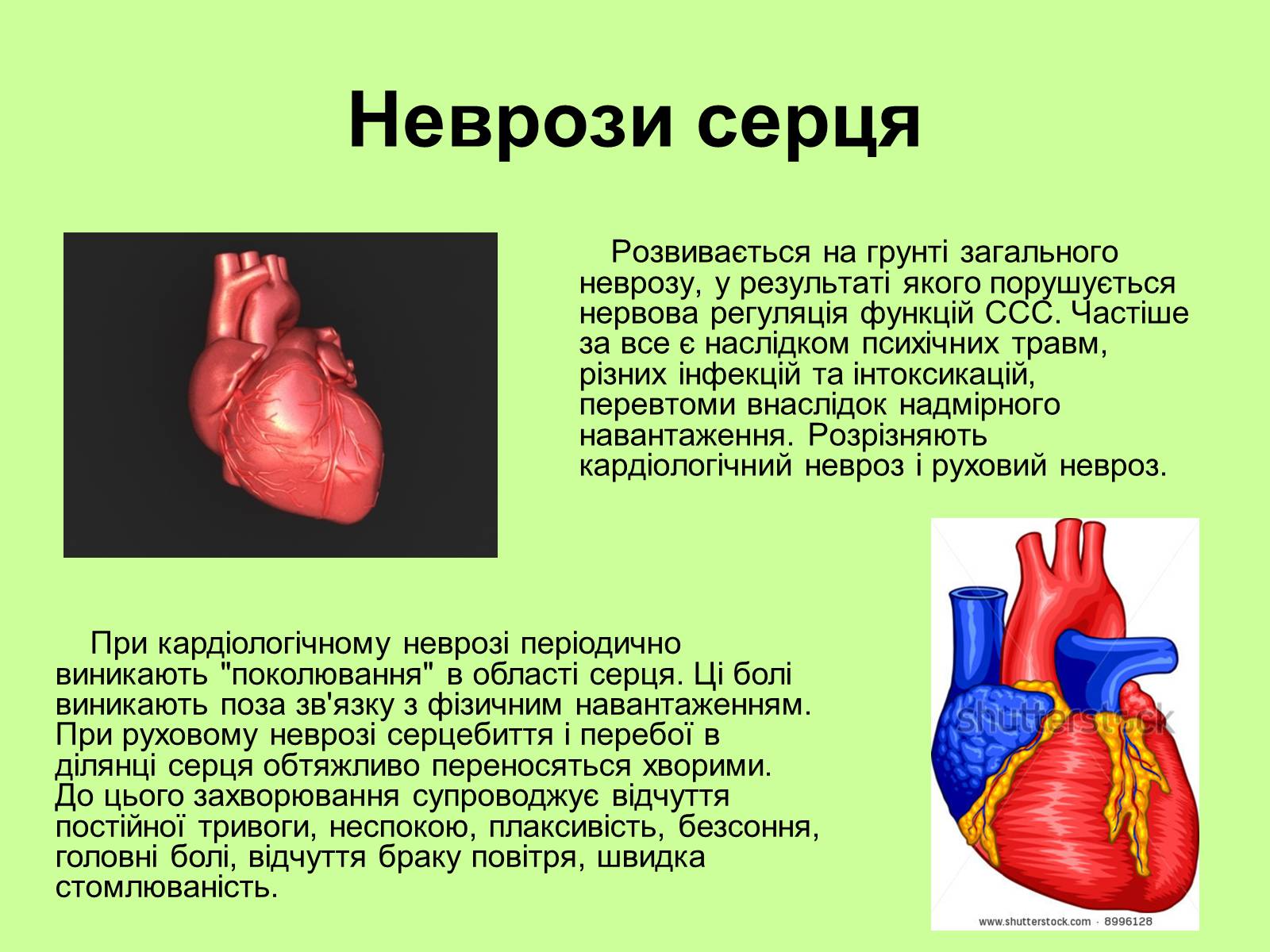 Презентація на тему «Хвороби серцево-судинної системи» (варіант 1) - Слайд #8