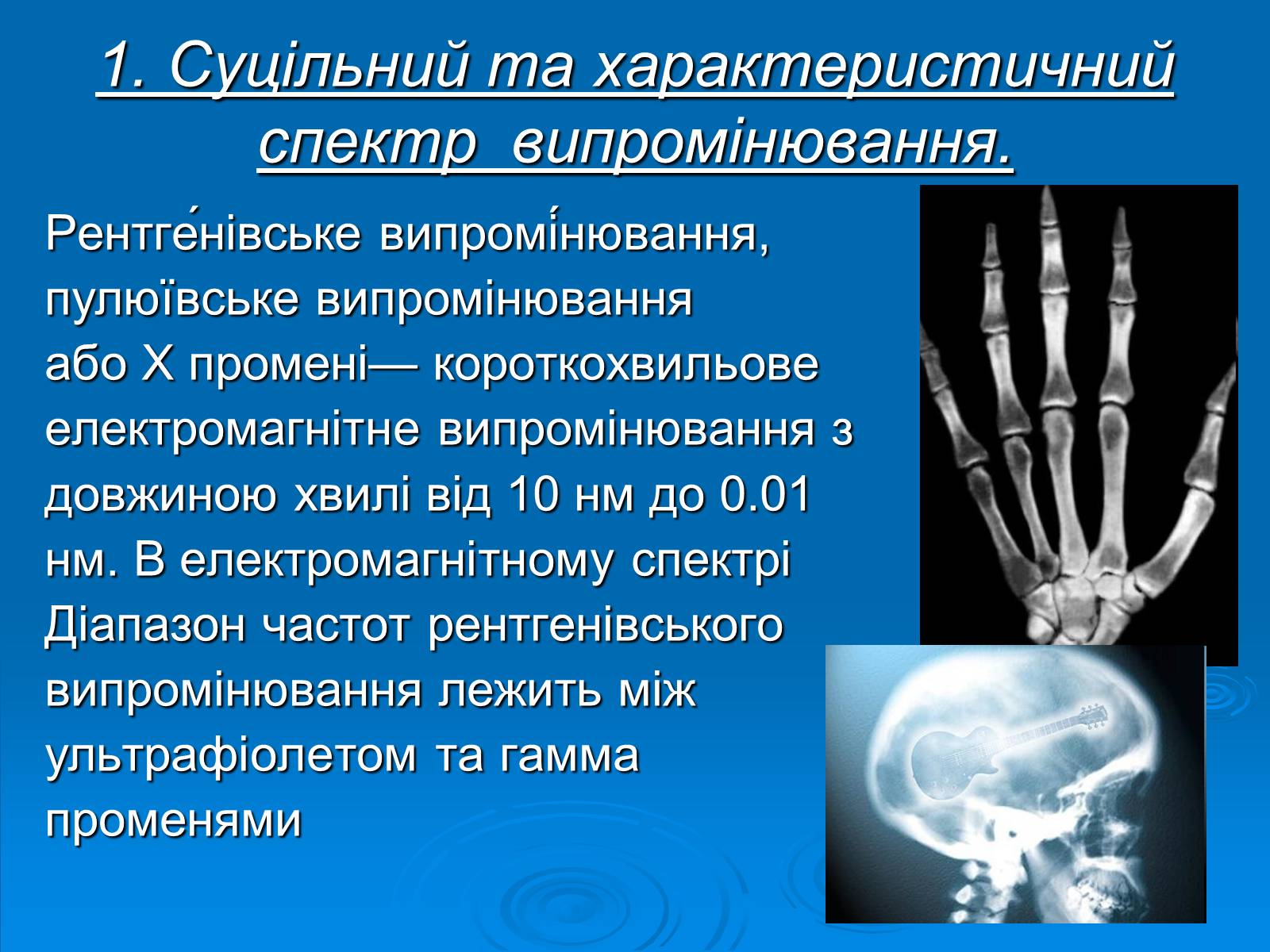 Презентація на тему «Рентгенівське випромінювання» (варіант 10) - Слайд #2