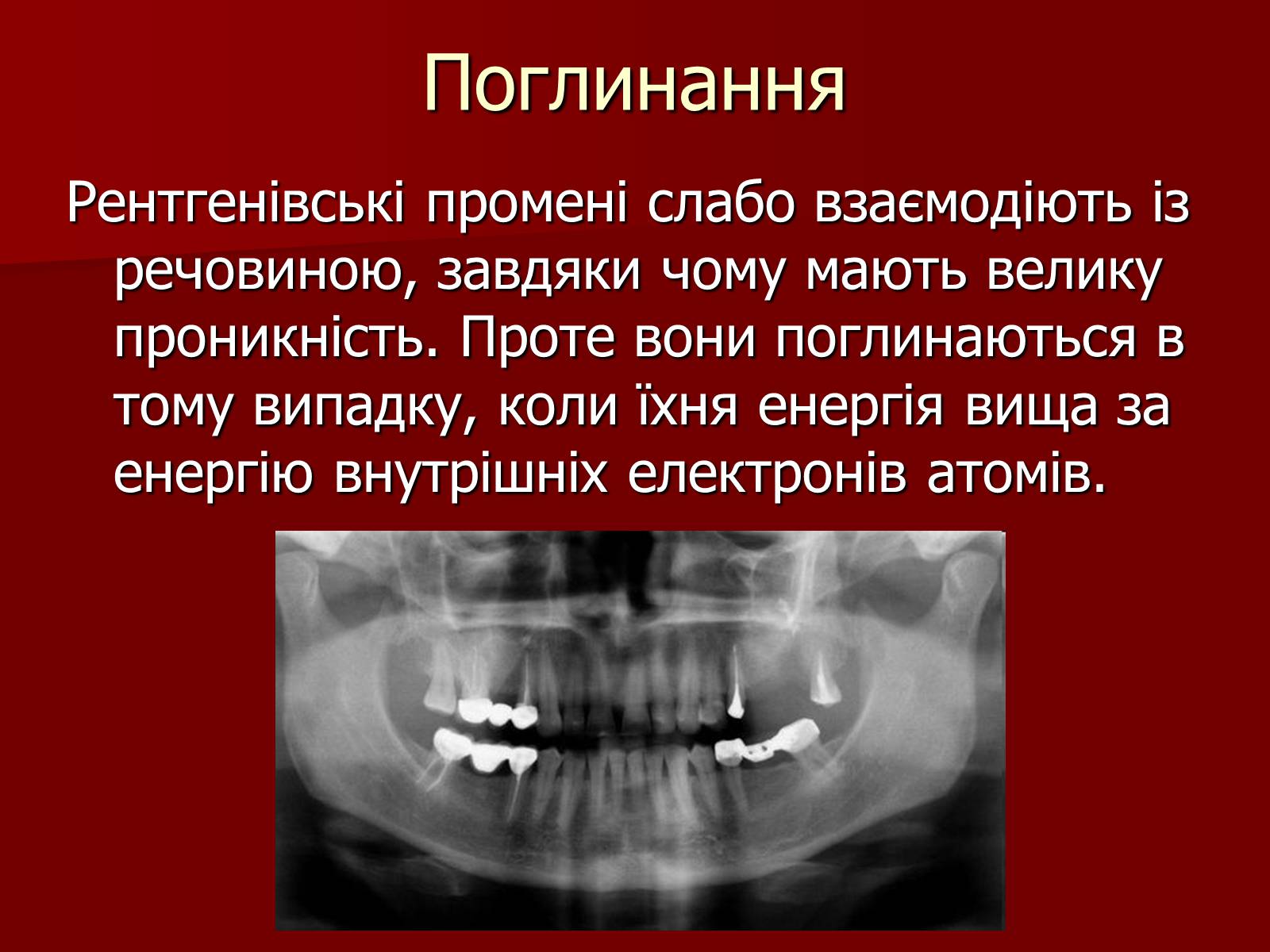 Презентація на тему «Рентгенівське випромінювання» (варіант 10) - Слайд #10