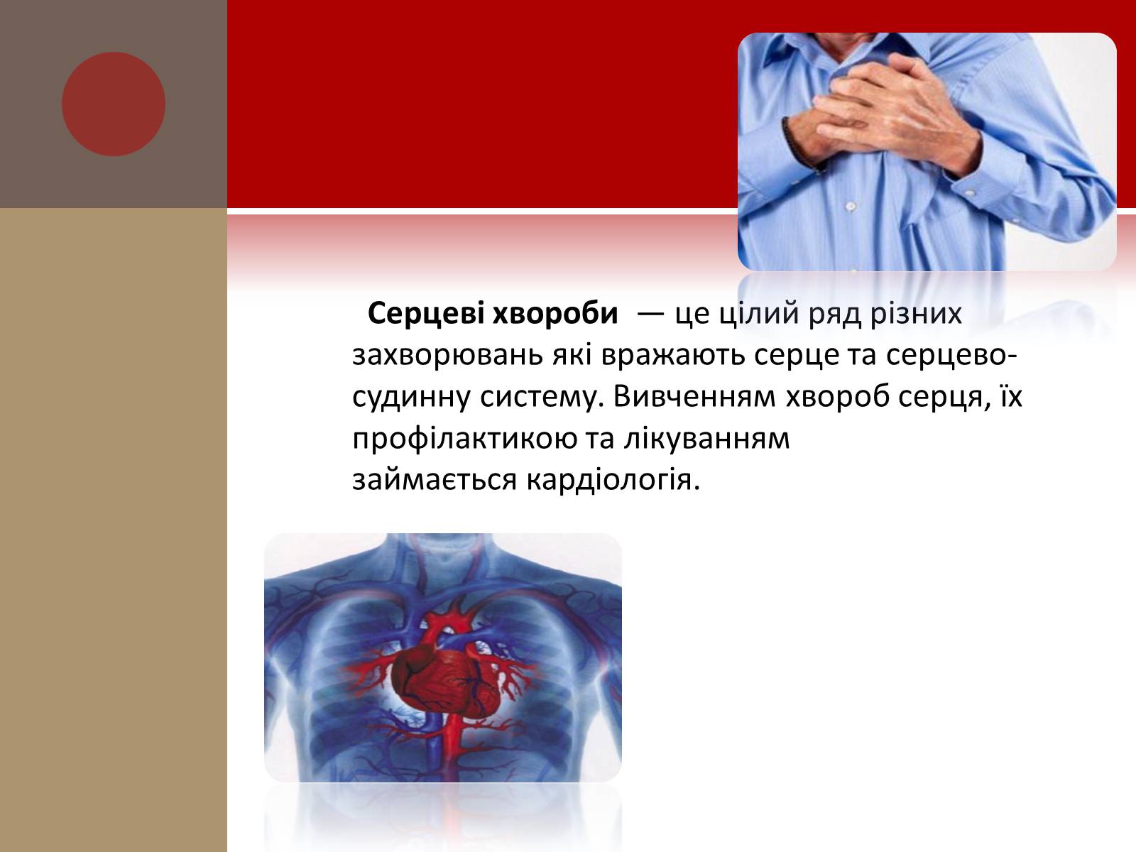 Презентація на тему «Захворювання серцево-судинної системи» (варіант 1) - Слайд #2
