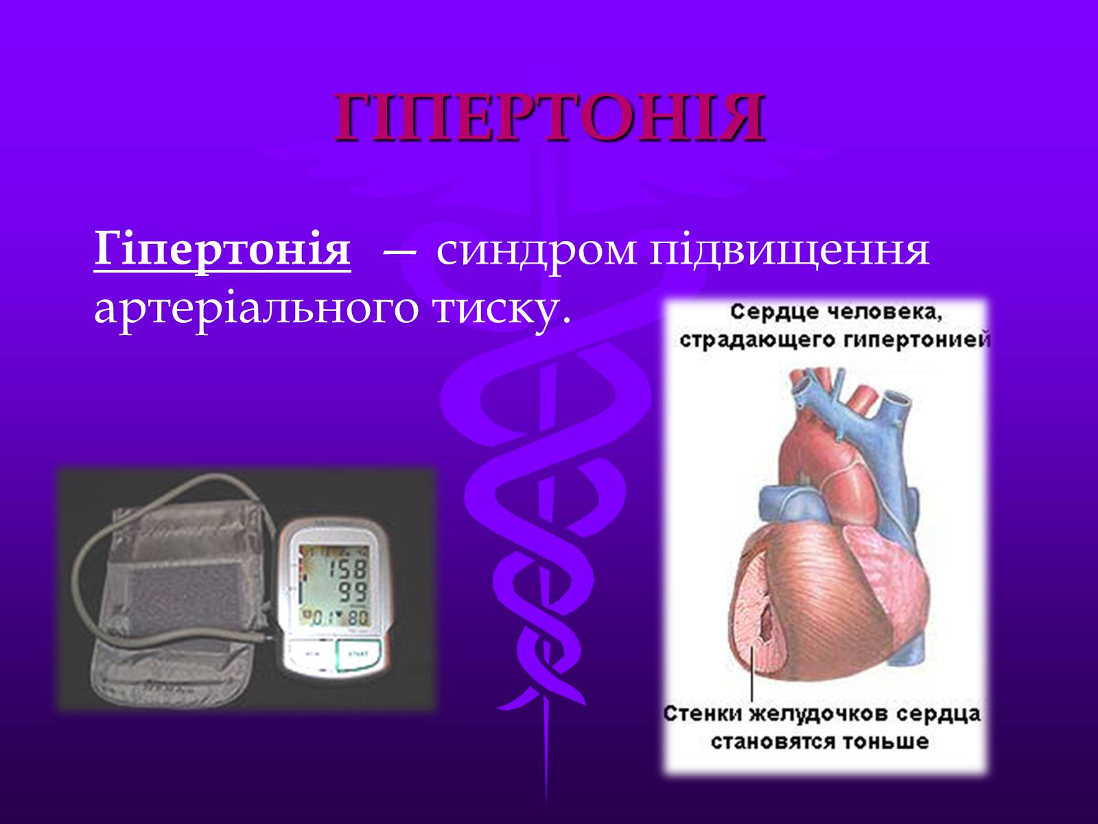 Презентація на тему «Хвороби серцево-судинної системи» (варіант 3) - Слайд #7