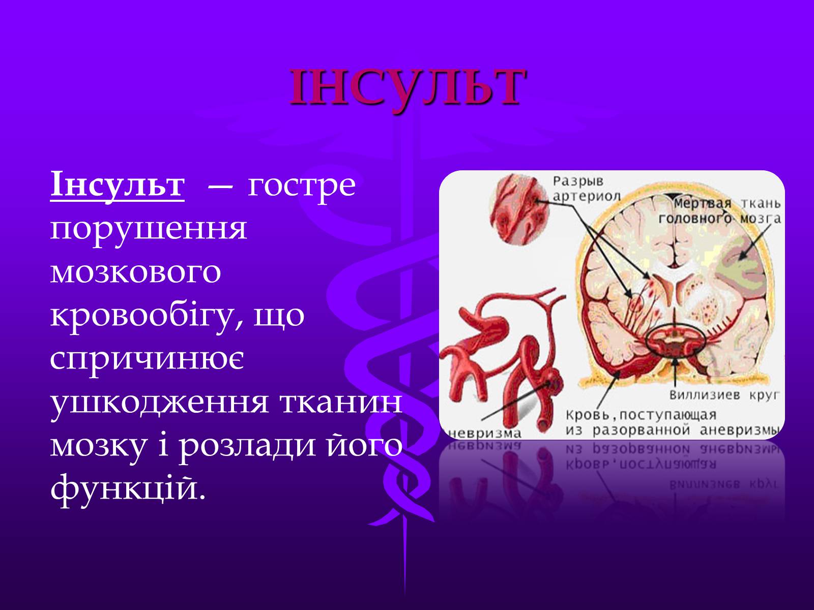 Презентація на тему «Хвороби серцево-судинної системи» (варіант 3) - Слайд #12