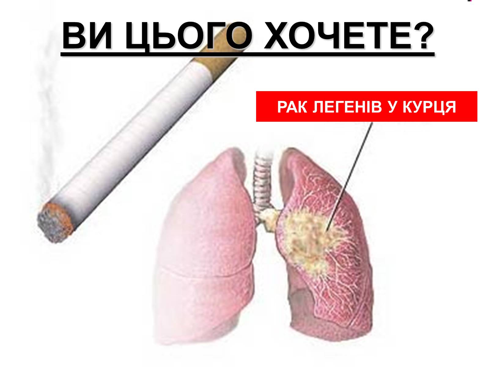 Презентація на тему «Тютюнопаління» (варіант 1) - Слайд #12
