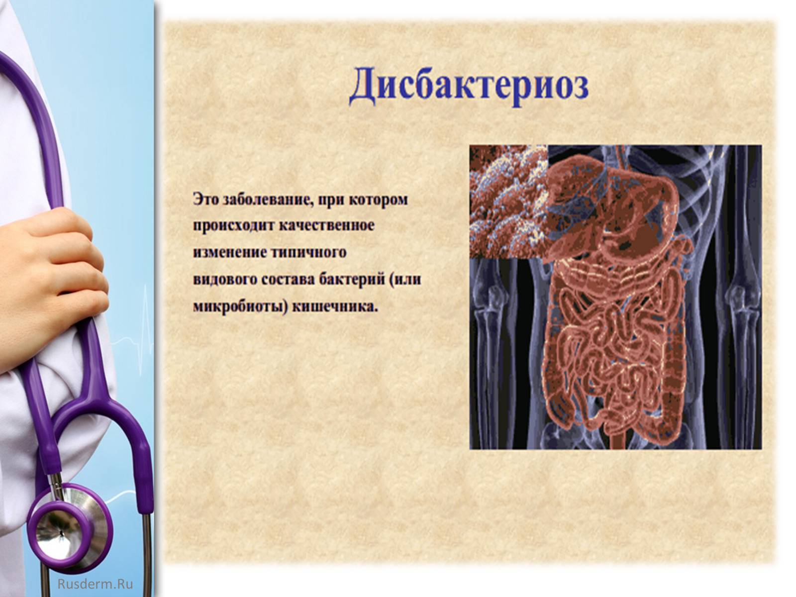 Презентація на тему «Заболевания пищеварительной системы» - Слайд #6