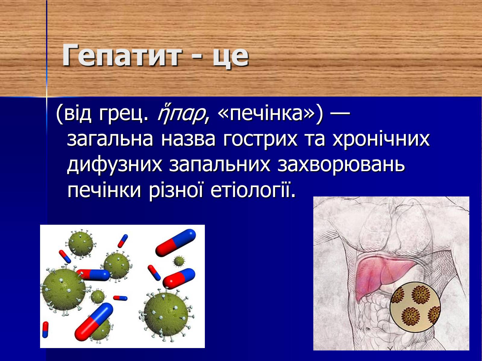 Презентація на тему «Гепатит» (варіант 1) - Слайд #3