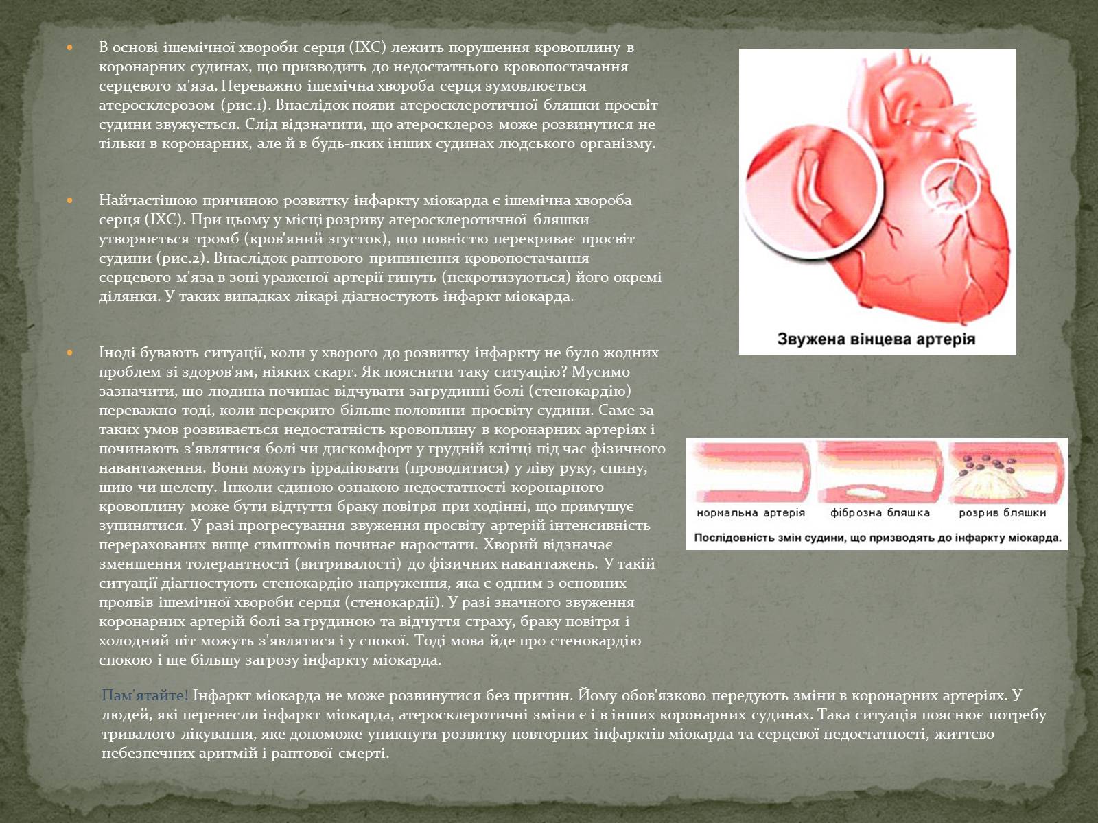 Презентація на тему «Ішемічні хвороби серця» - Слайд #3