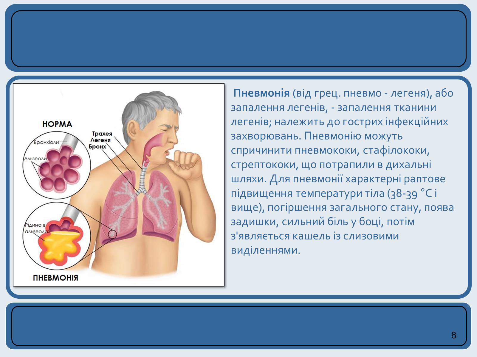 Презентація на тему «Хвороби органів дихання та їх профілактика» (варіант 2) - Слайд #8