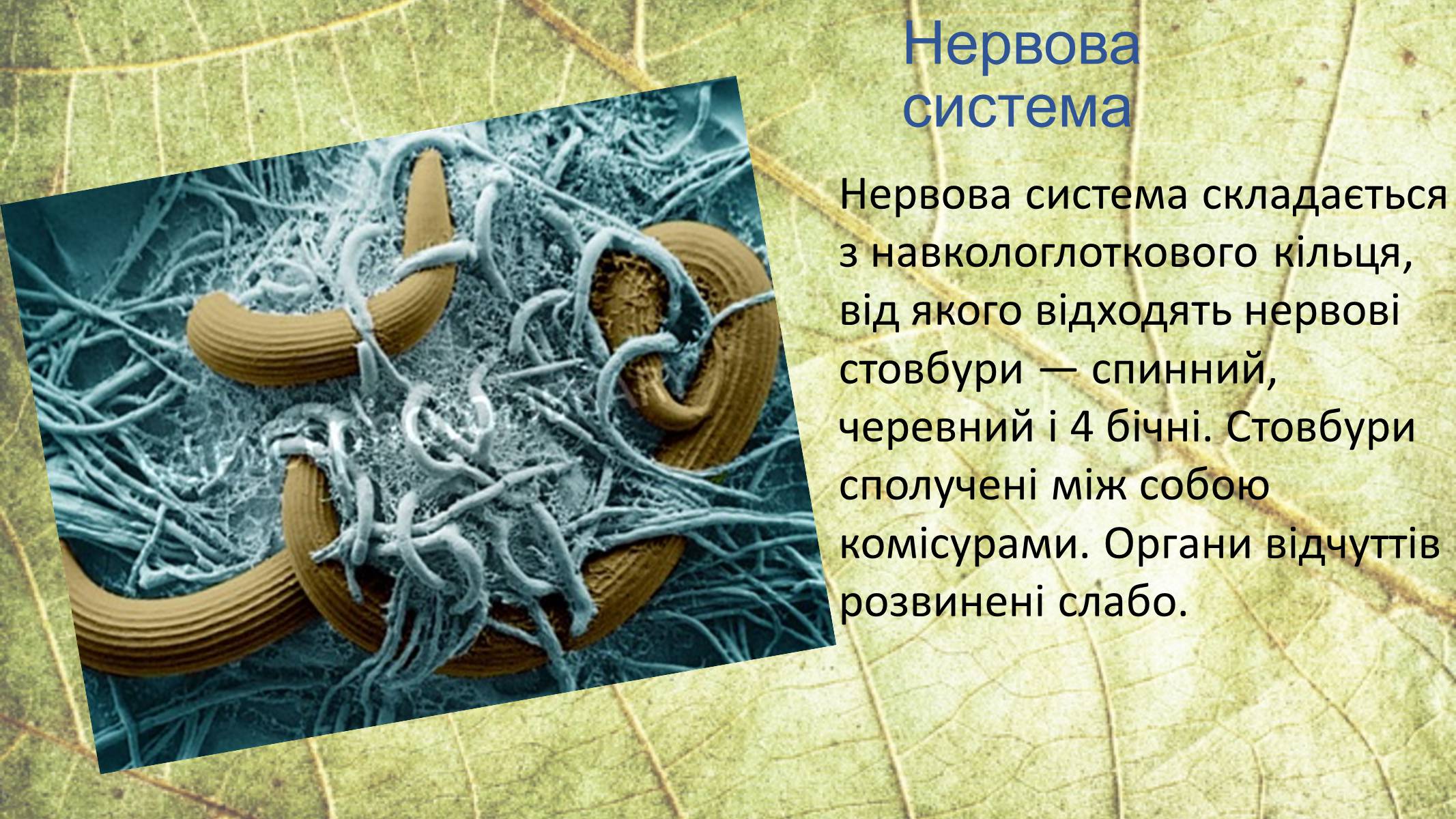 Презентація на тему «Круглі черви» - Слайд #12
