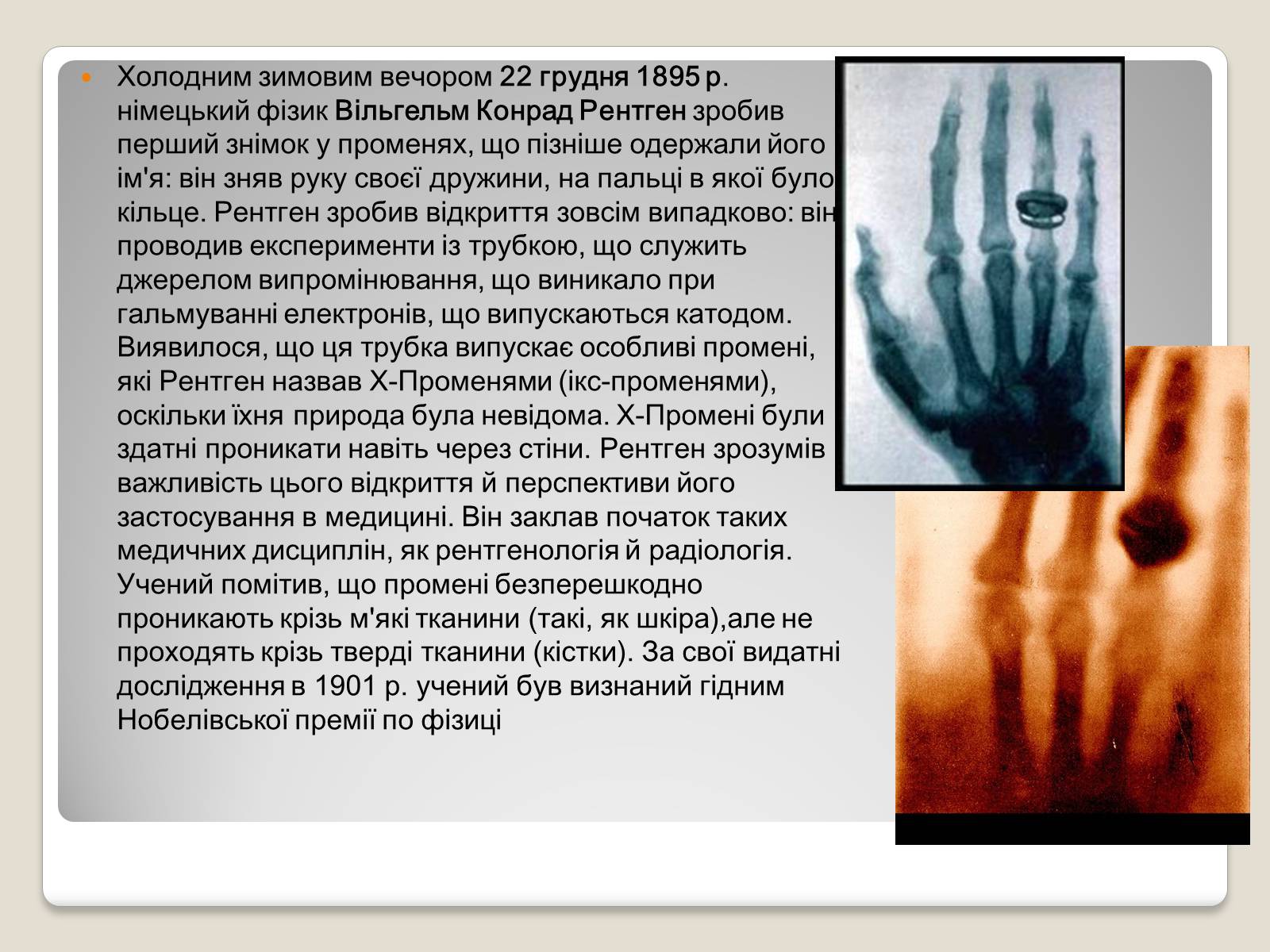 Презентація на тему «Рентгенівське випромінювання» (варіант 11) - Слайд #3