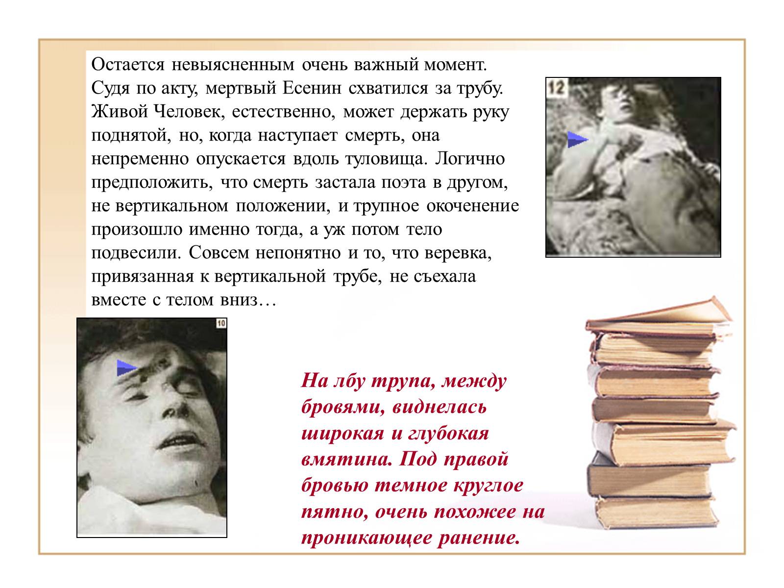 Презентація на тему «Тайна смерти Сергея Есенина» - Слайд #19
