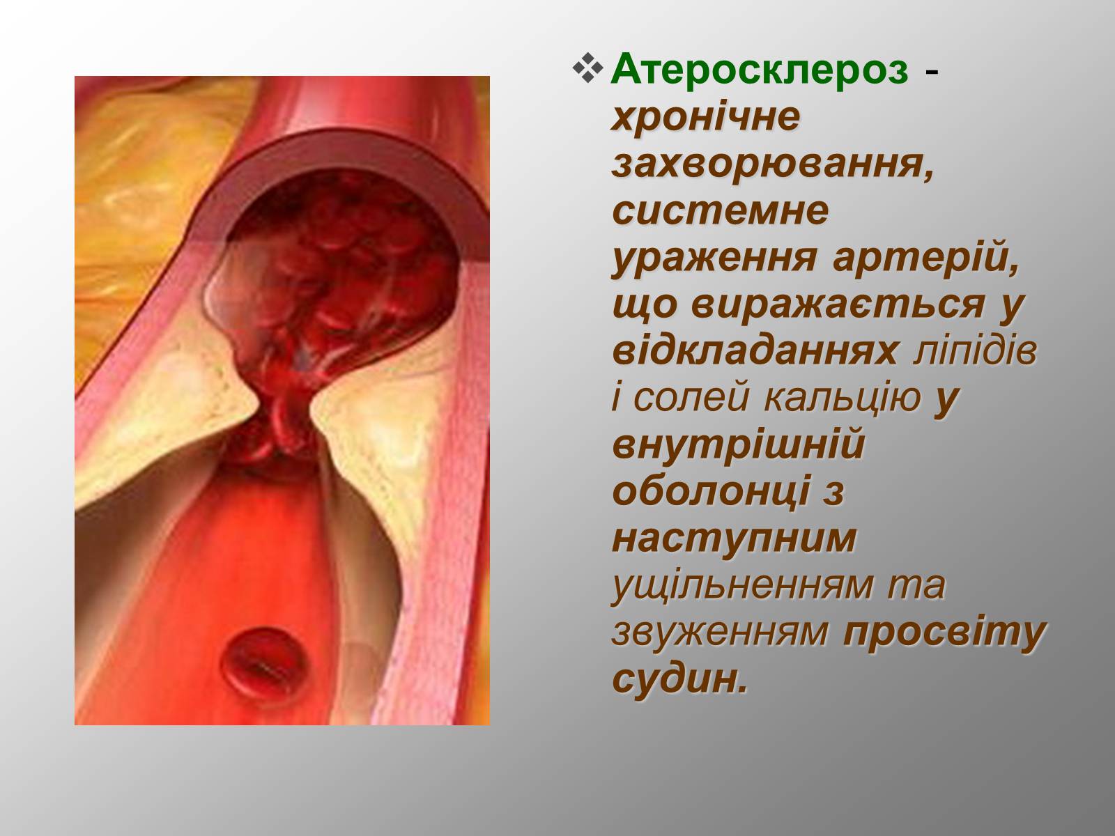 Презентація на тему «Серцево-судинна система людини» - Слайд #4