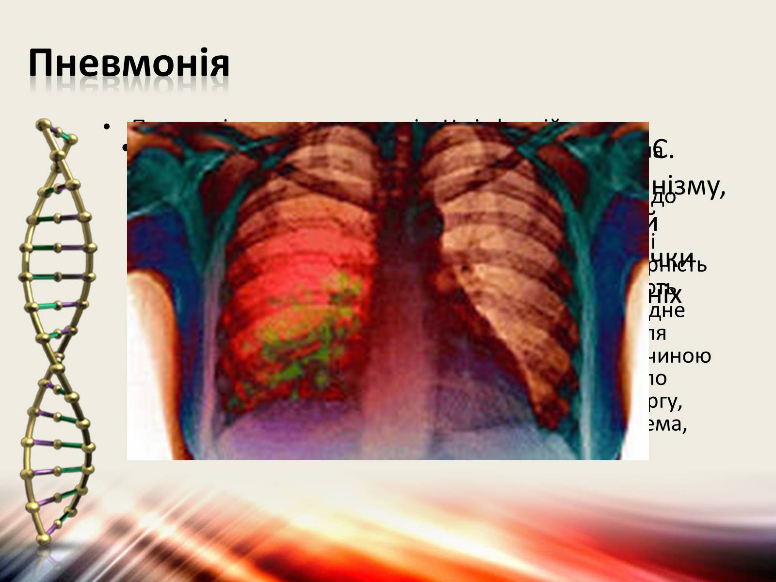 Презентація на тему «Захворювання дихальної системи» (варіант 1) - Слайд #18