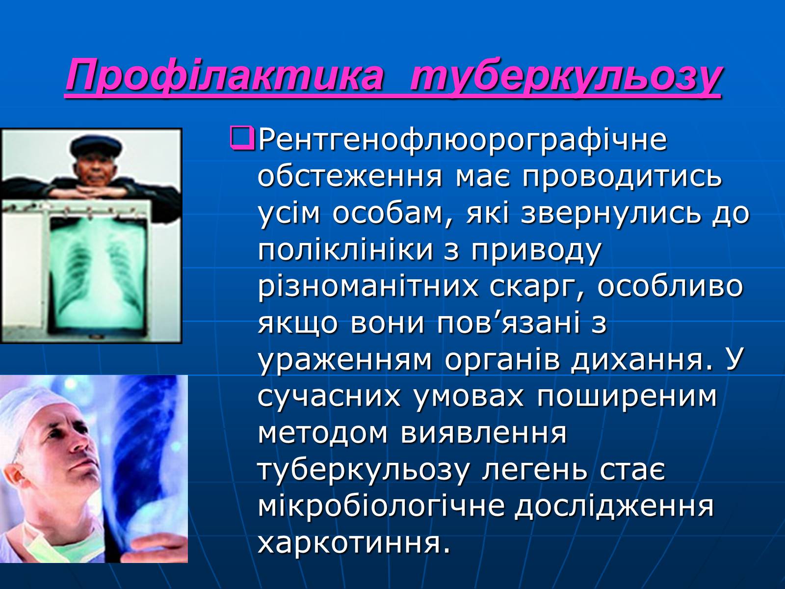 Презентація на тему «Проблема туберкульозу в Україні» - Слайд #17