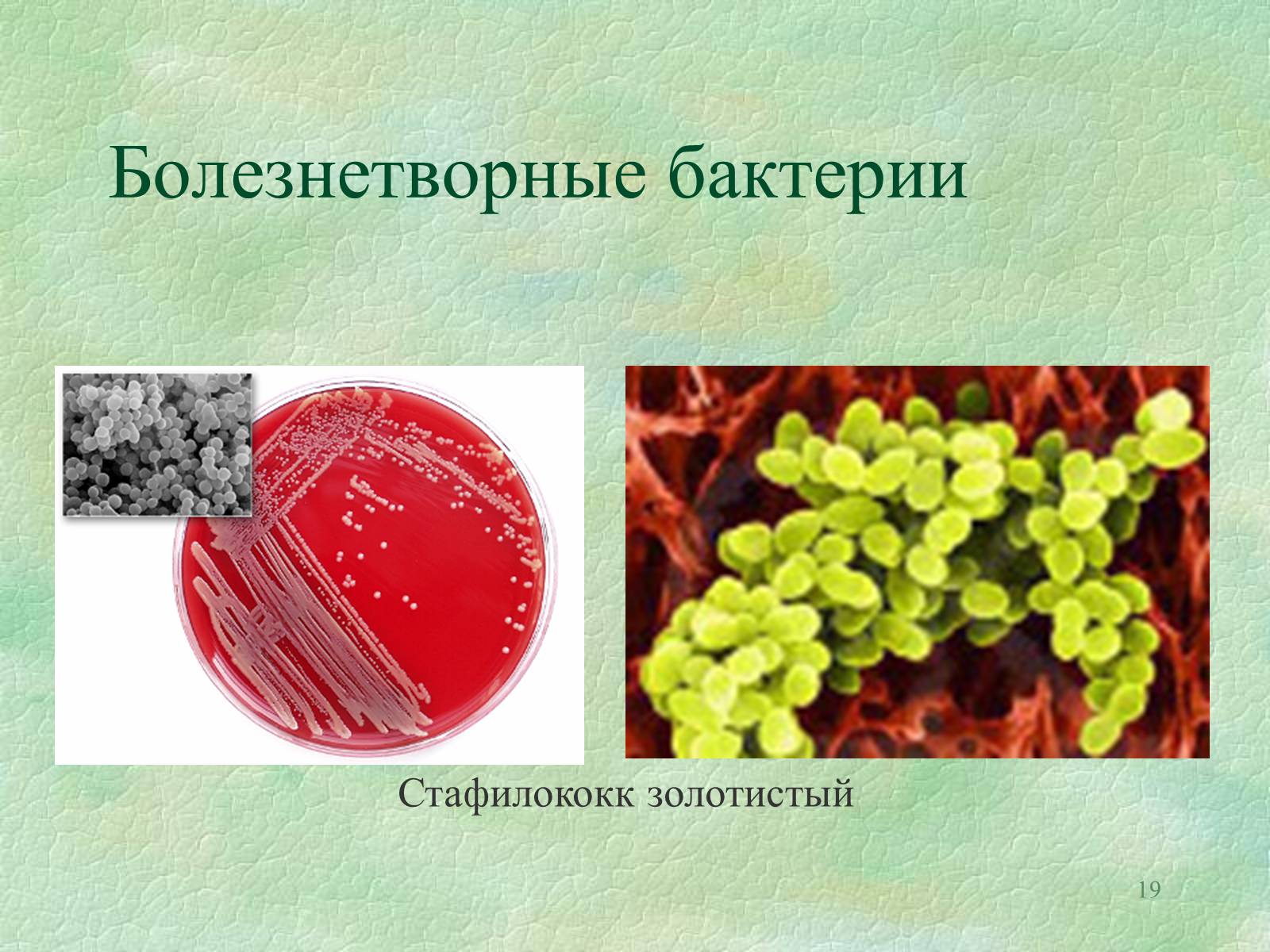 Презентація на тему «Значение бактерий в природе и жизни человека» - Слайд #19