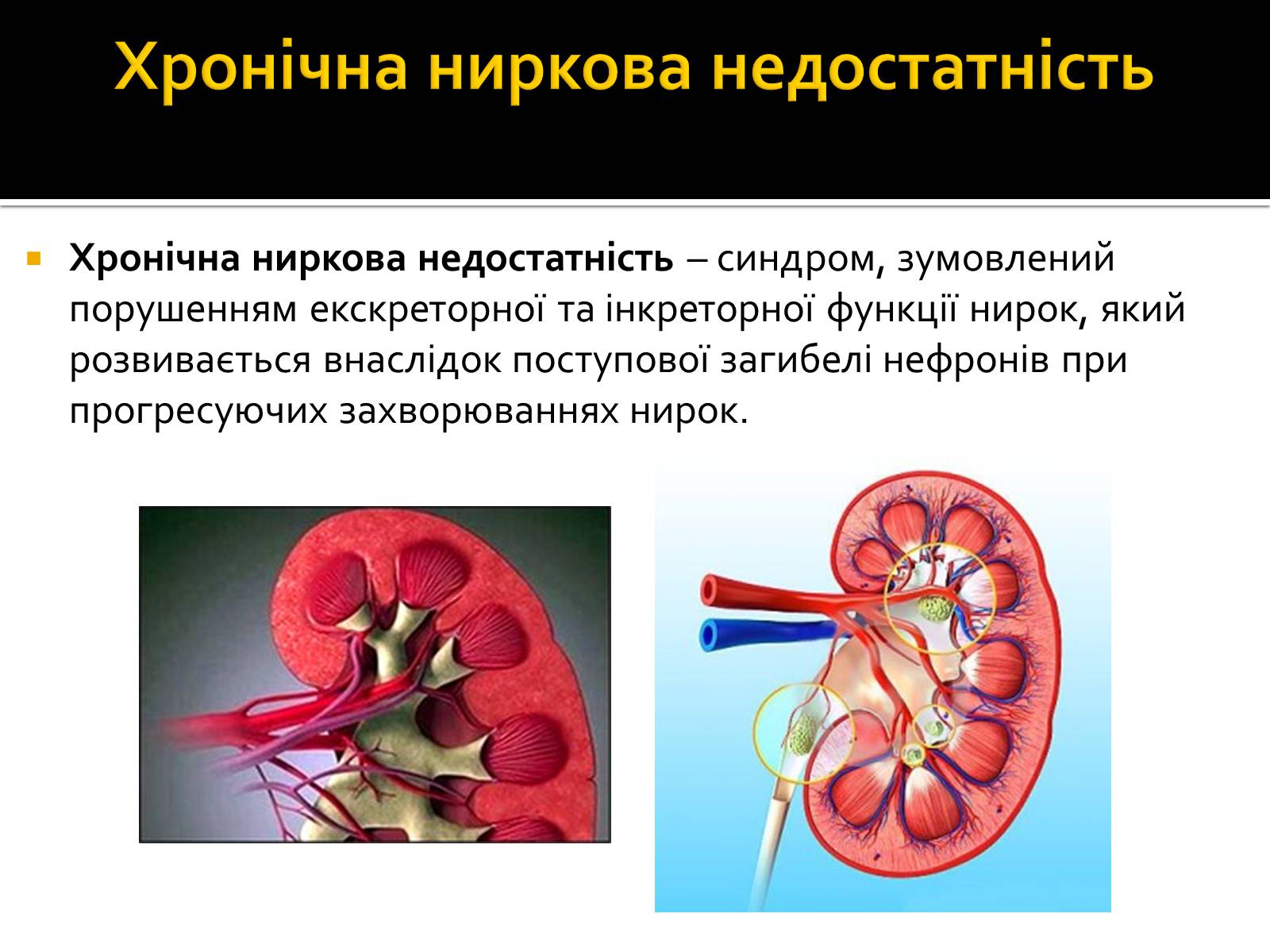 Презентація на тему «Захворювання нирок та сечовивідних шляхів» - Слайд #6