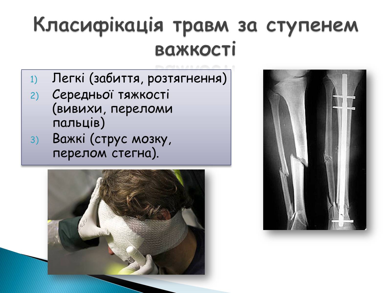 Презентація на тему «Травма систем організму» (варіант 2) - Слайд #6