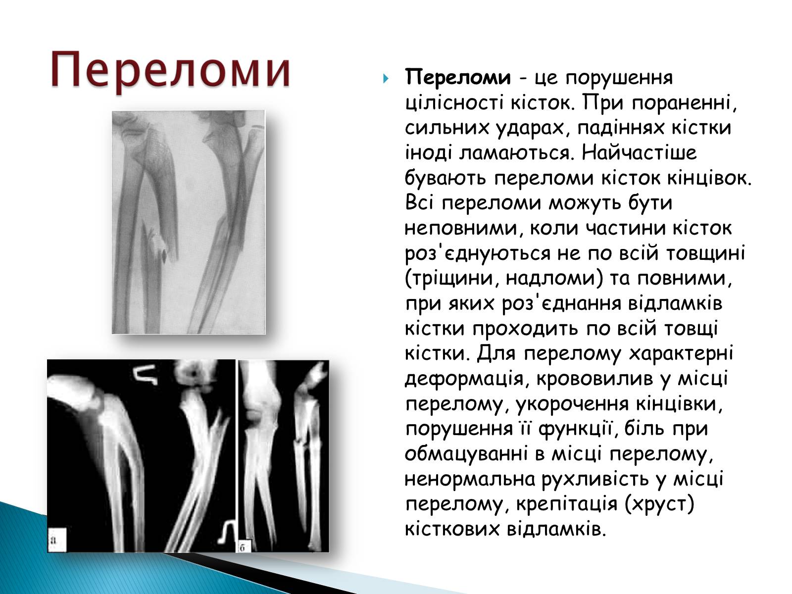 Презентація на тему «Травма систем організму» (варіант 2) - Слайд #13