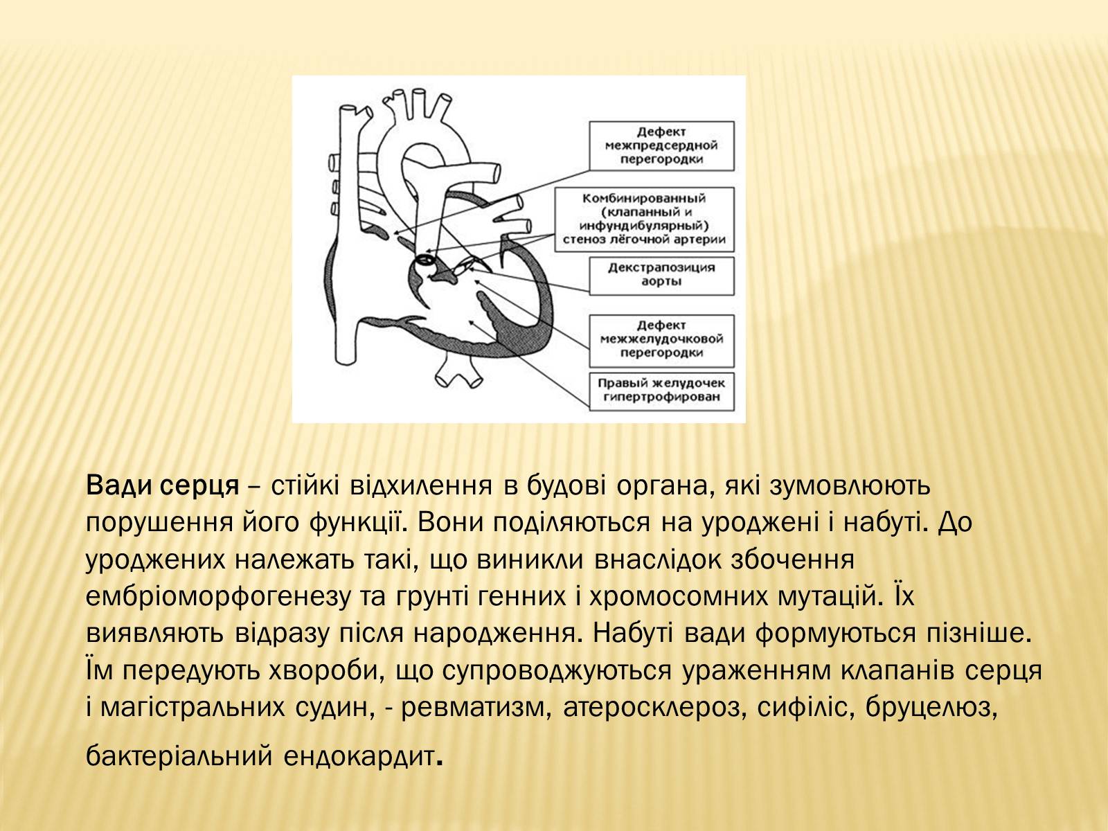 Презентація на тему «Захворювання серцево-судинної системи» (варіант 3) - Слайд #9