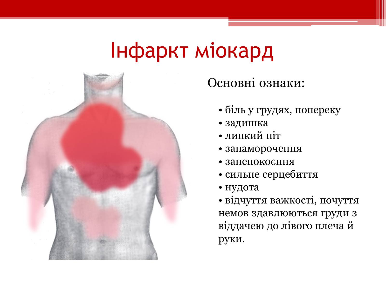 Презентація на тему «Захворювання серцево – судинної системи. Профілактика» - Слайд #7