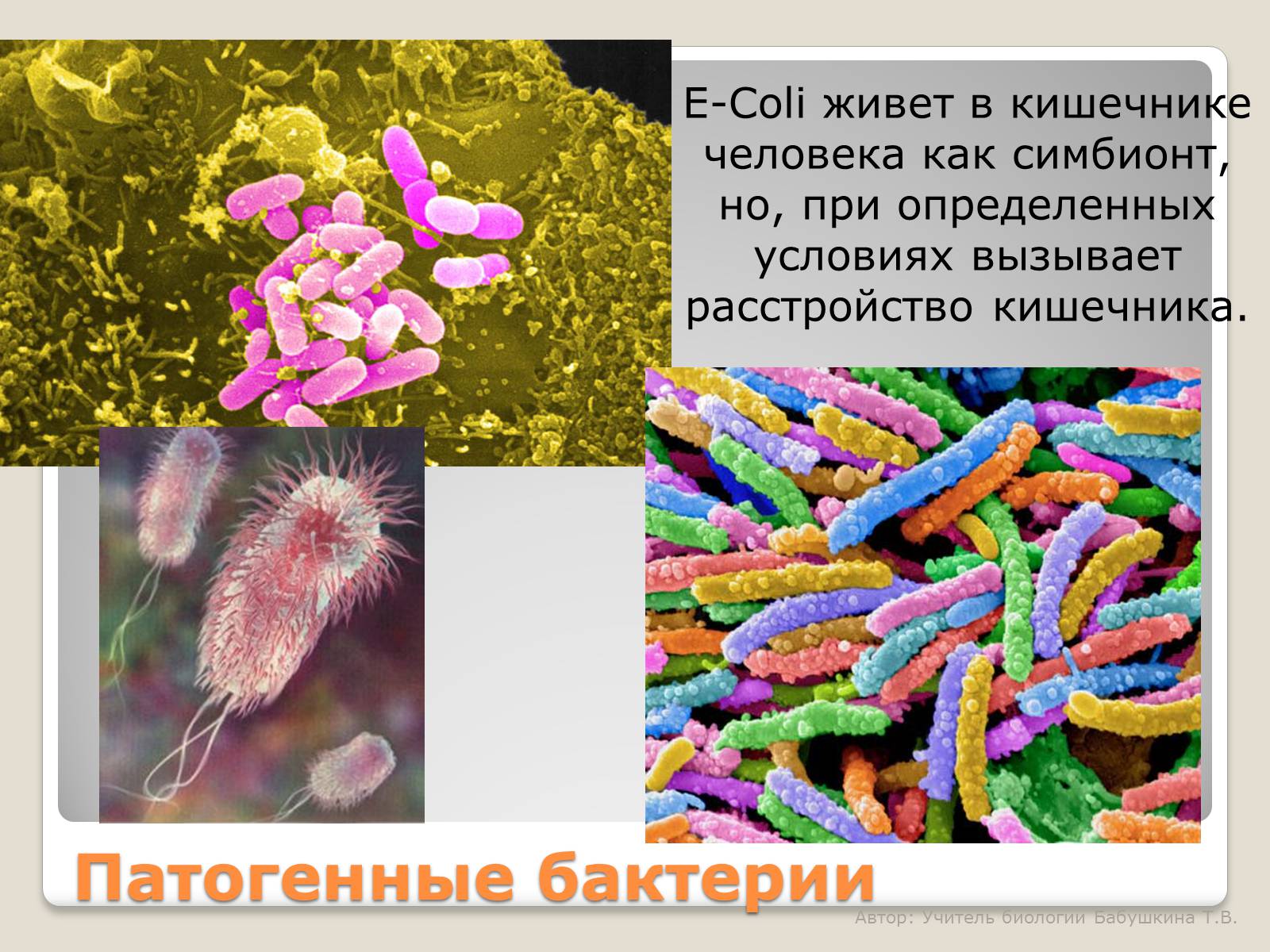 Презентація на тему «Царство Бактерии» - Слайд #15