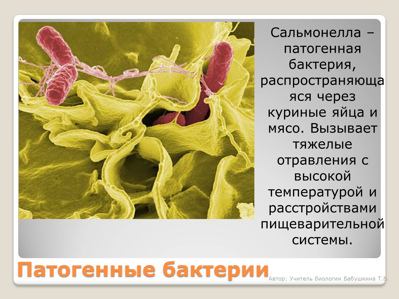 Презентація на тему «Царство Бактерии» - Слайд #16